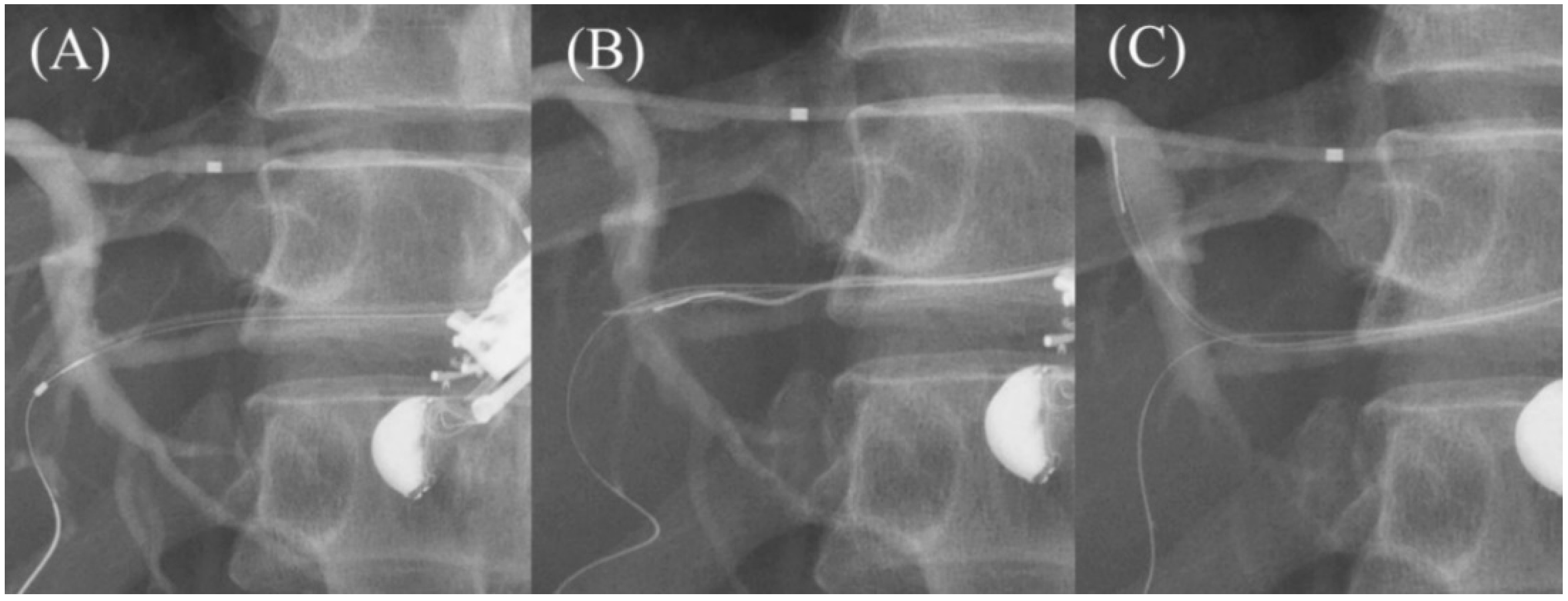 Jcm 11 01591 g013 Jcm 11 01591 g013