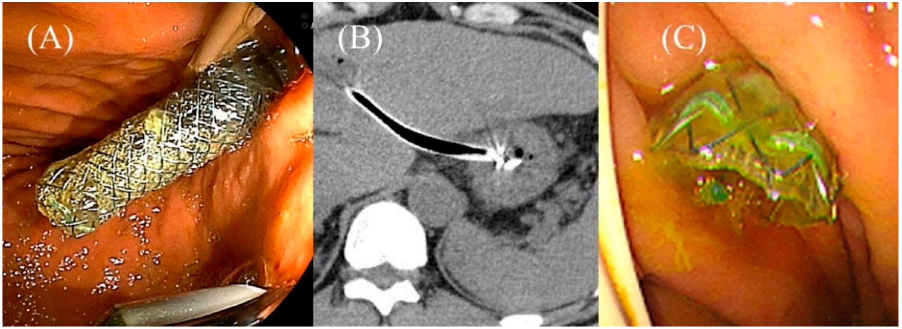 Jcm 11 01591 g017 Jcm 11 01591 g017