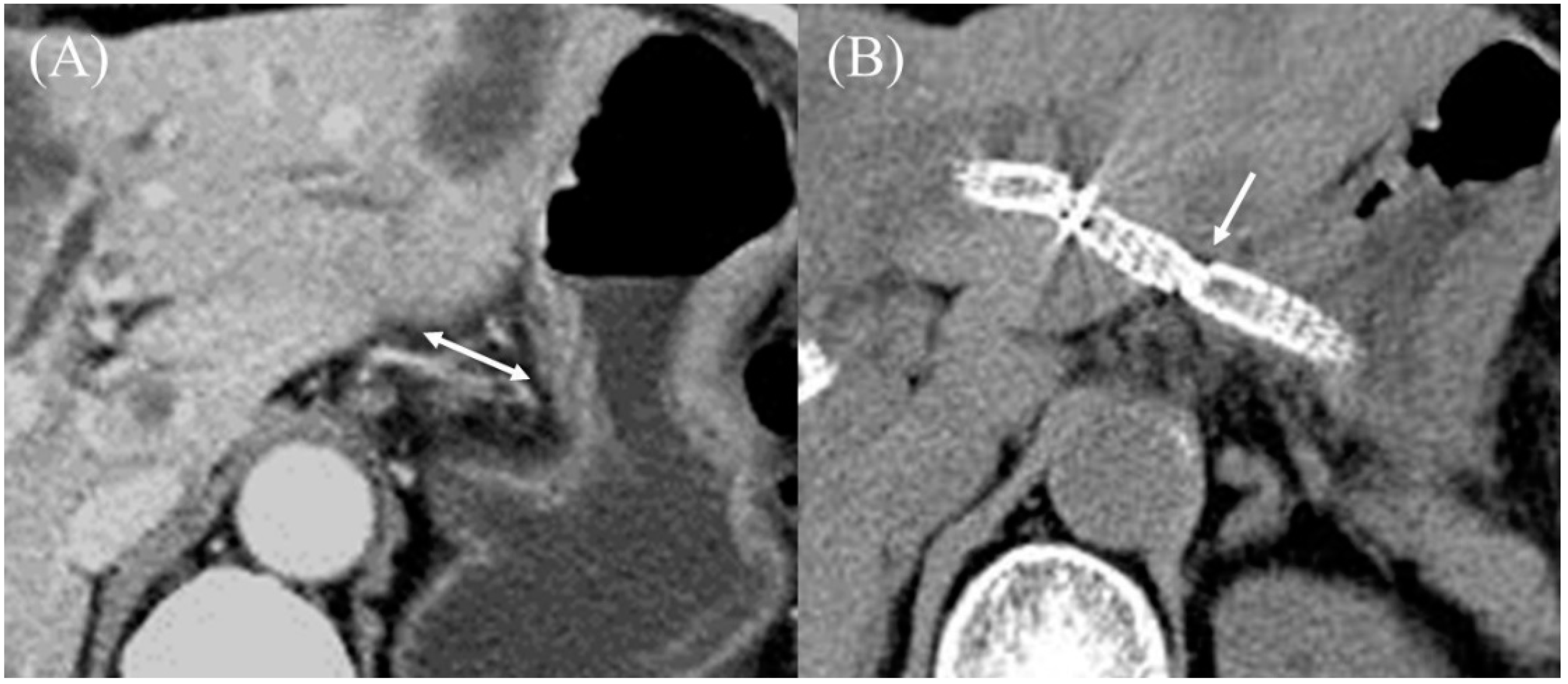 Jcm 11 01591 g020 Jcm 11 01591 g020