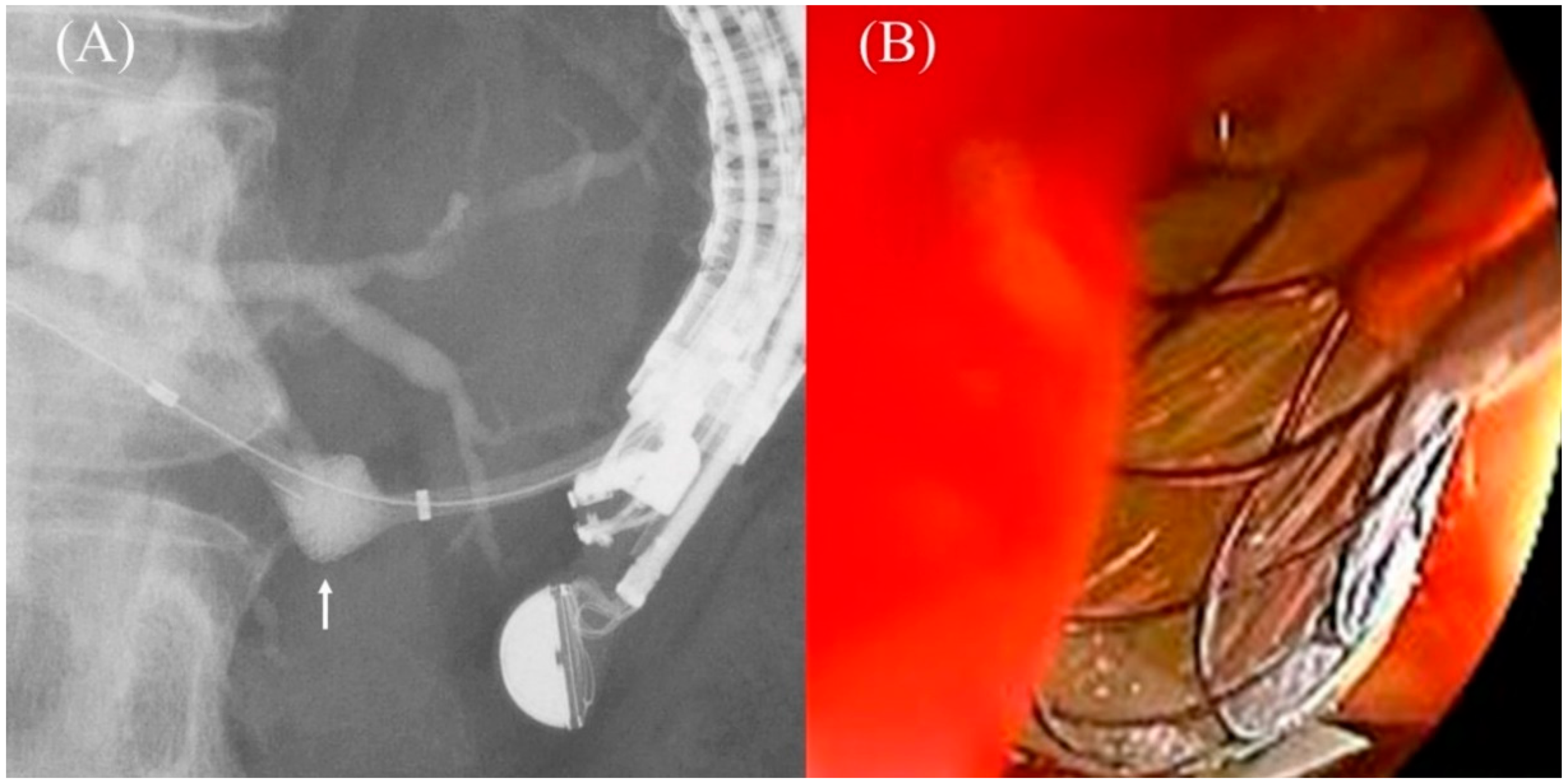 Jcm 11 01591 g021 Jcm 11 01591 g021