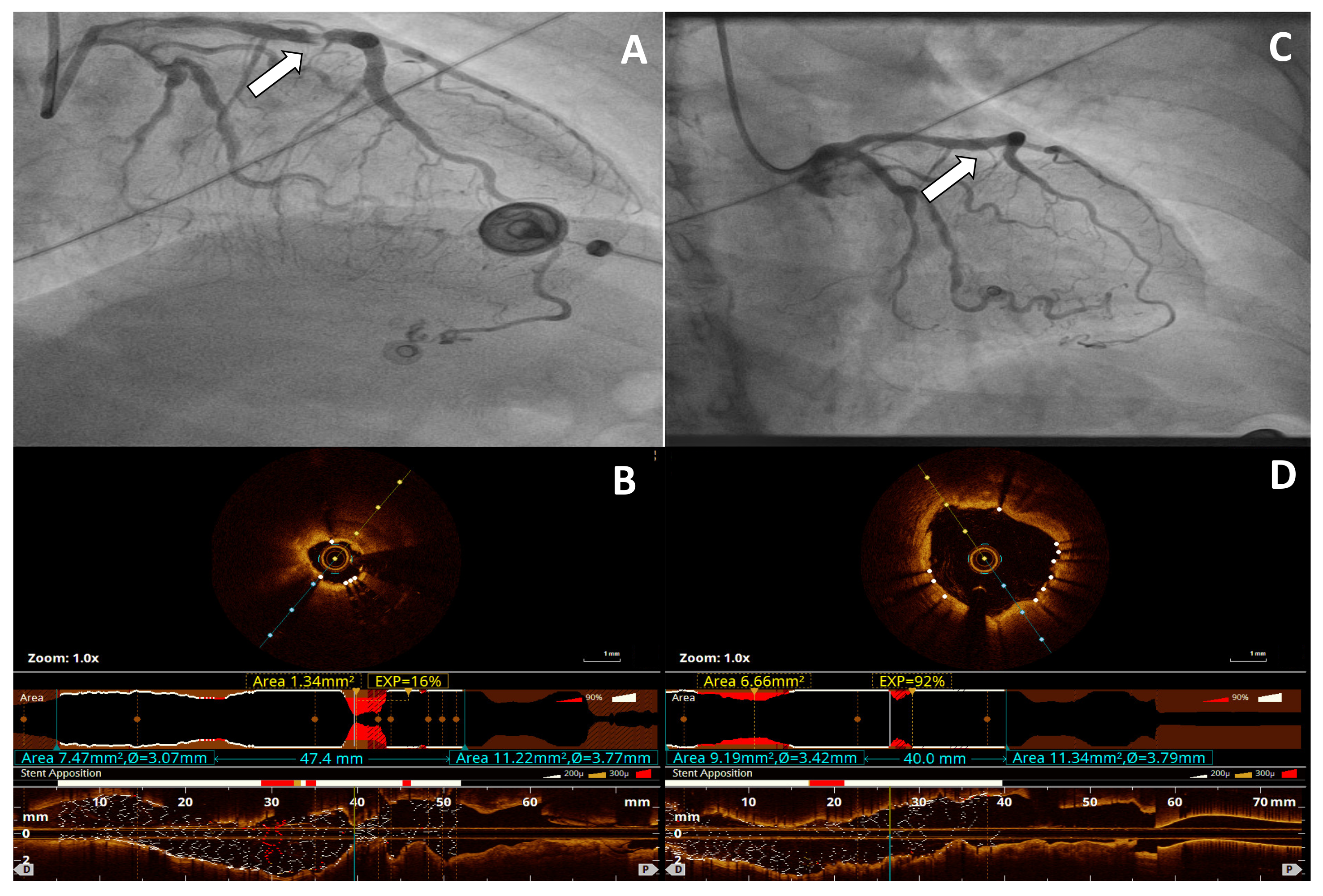 Jcm 11 01779 g001 Jcm 11 01779 g001