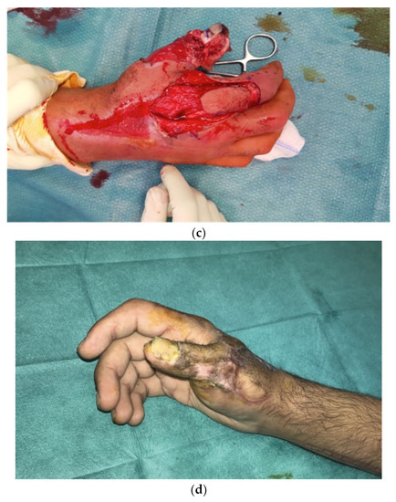 Jcm 11 02182 g002b 550