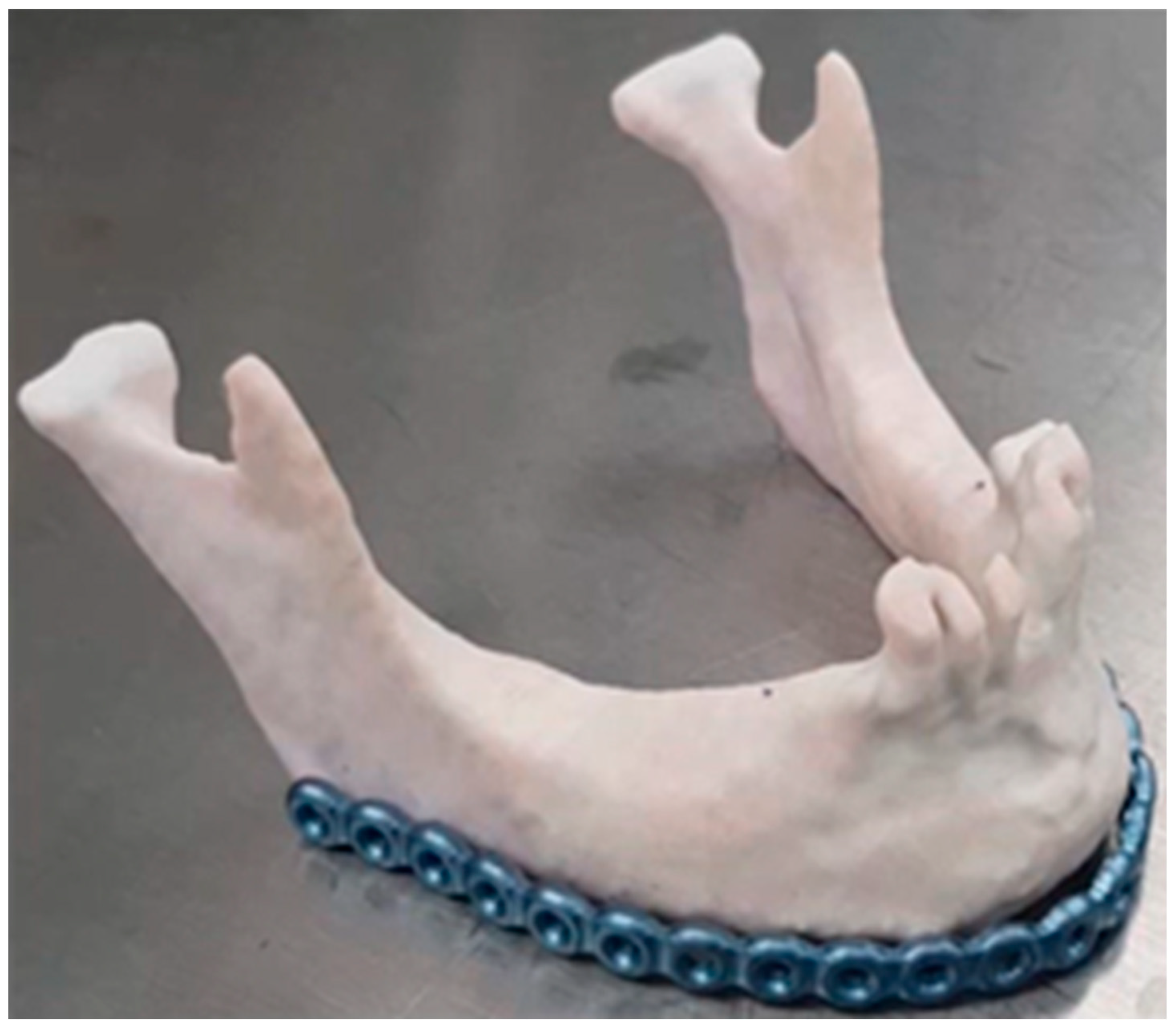 Jcm 11 02385 g004 Jcm 11 02385 g004