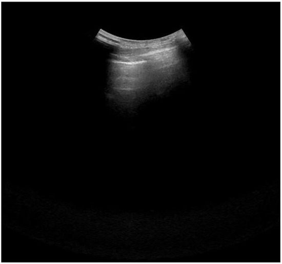 Jcm 11 02718 g0a1 550