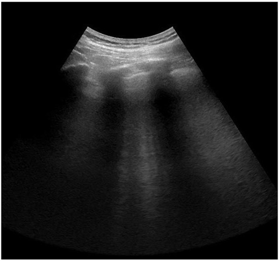 Jcm 11 02718 g0a2 550