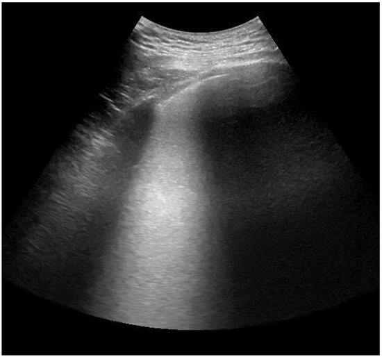 Jcm 11 02718 g0a3 550