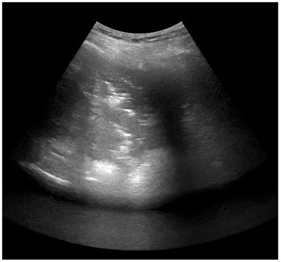 Jcm 11 02718 g0a4 550