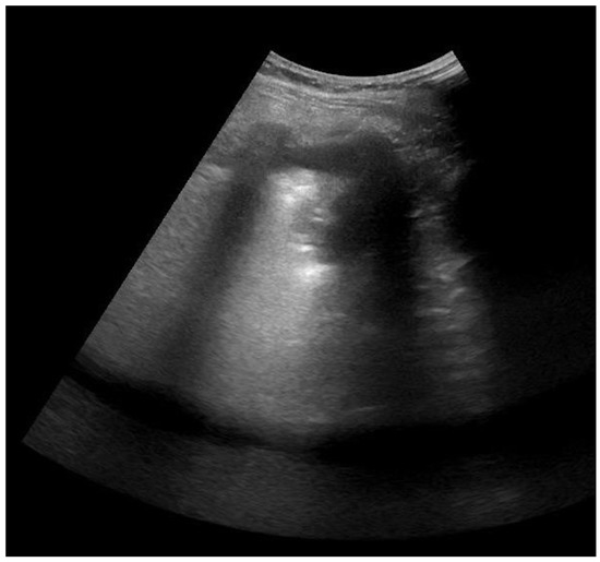 Jcm 11 02718 g0a5 550