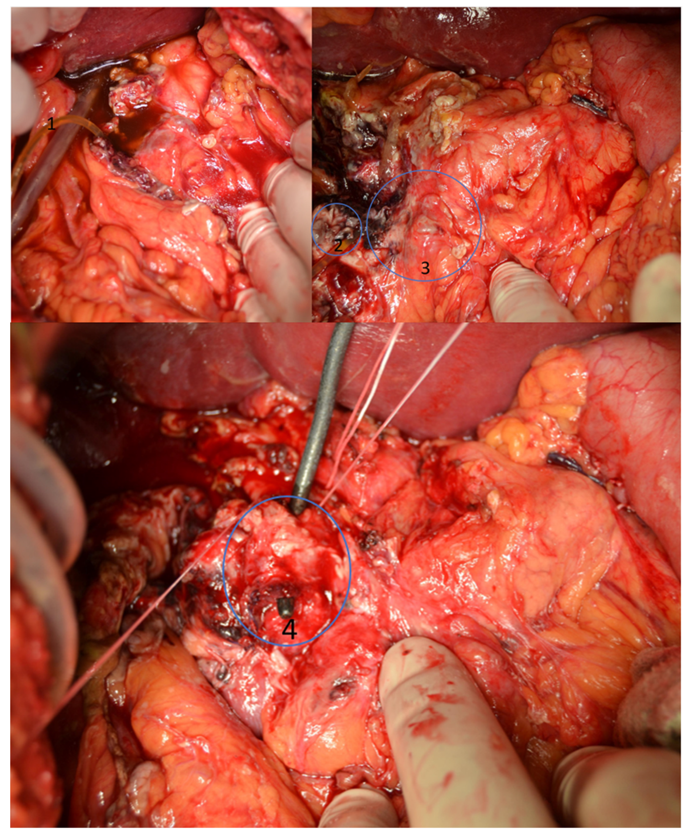 Jcm 11 02891 g001 Jcm 11 02891 g001