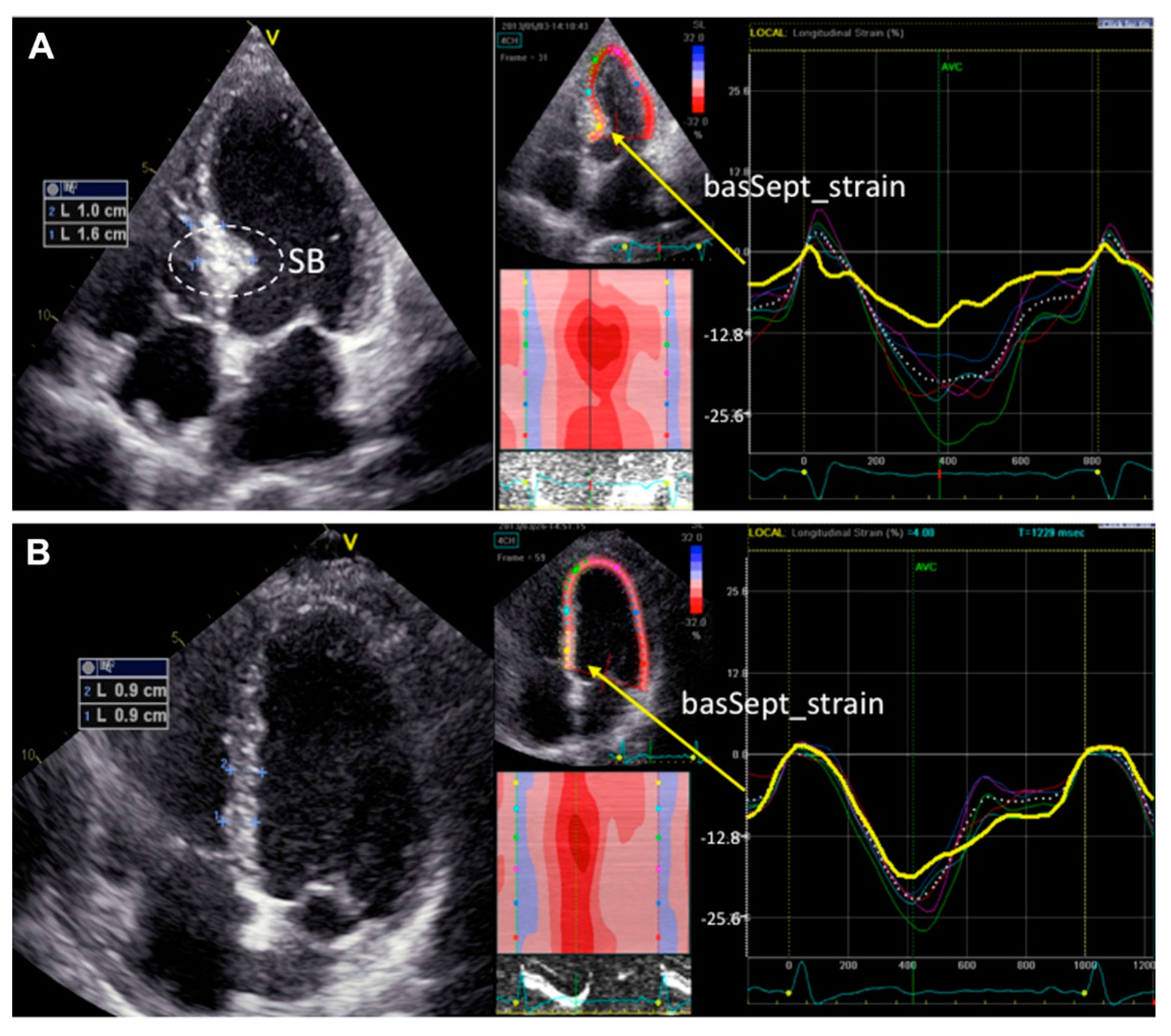 Jcm 11 03227 g002 Jcm 11 03227 g002