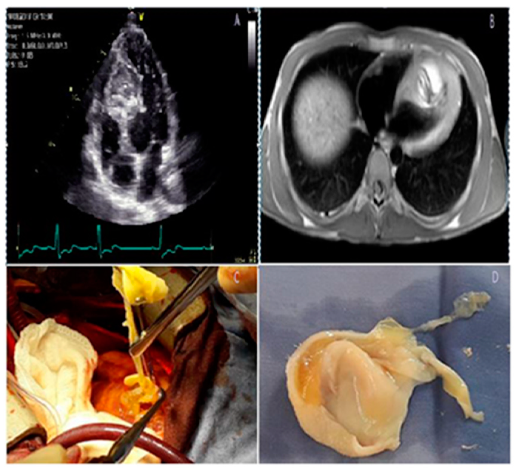 Jcm 11 03227 g005 Jcm 11 03227 g005