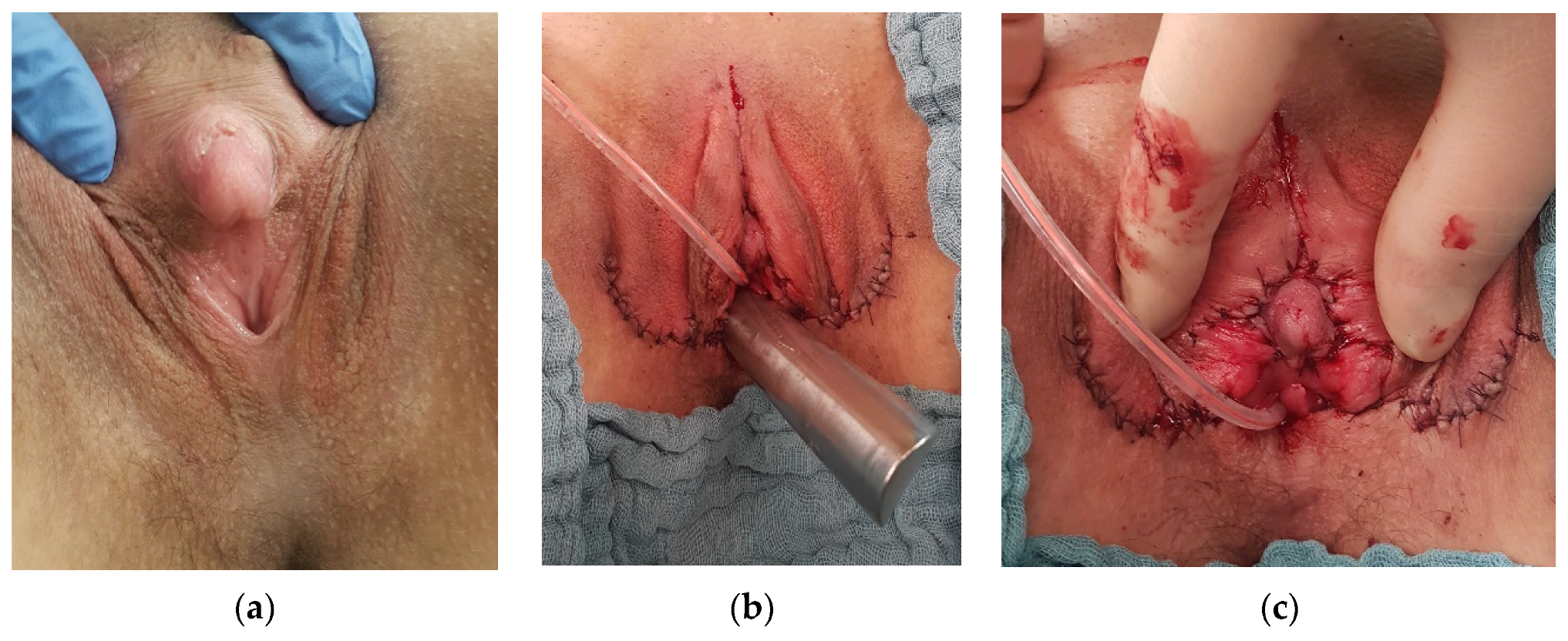 Jcm 11 03688 g004 Jcm 11 03688 g004