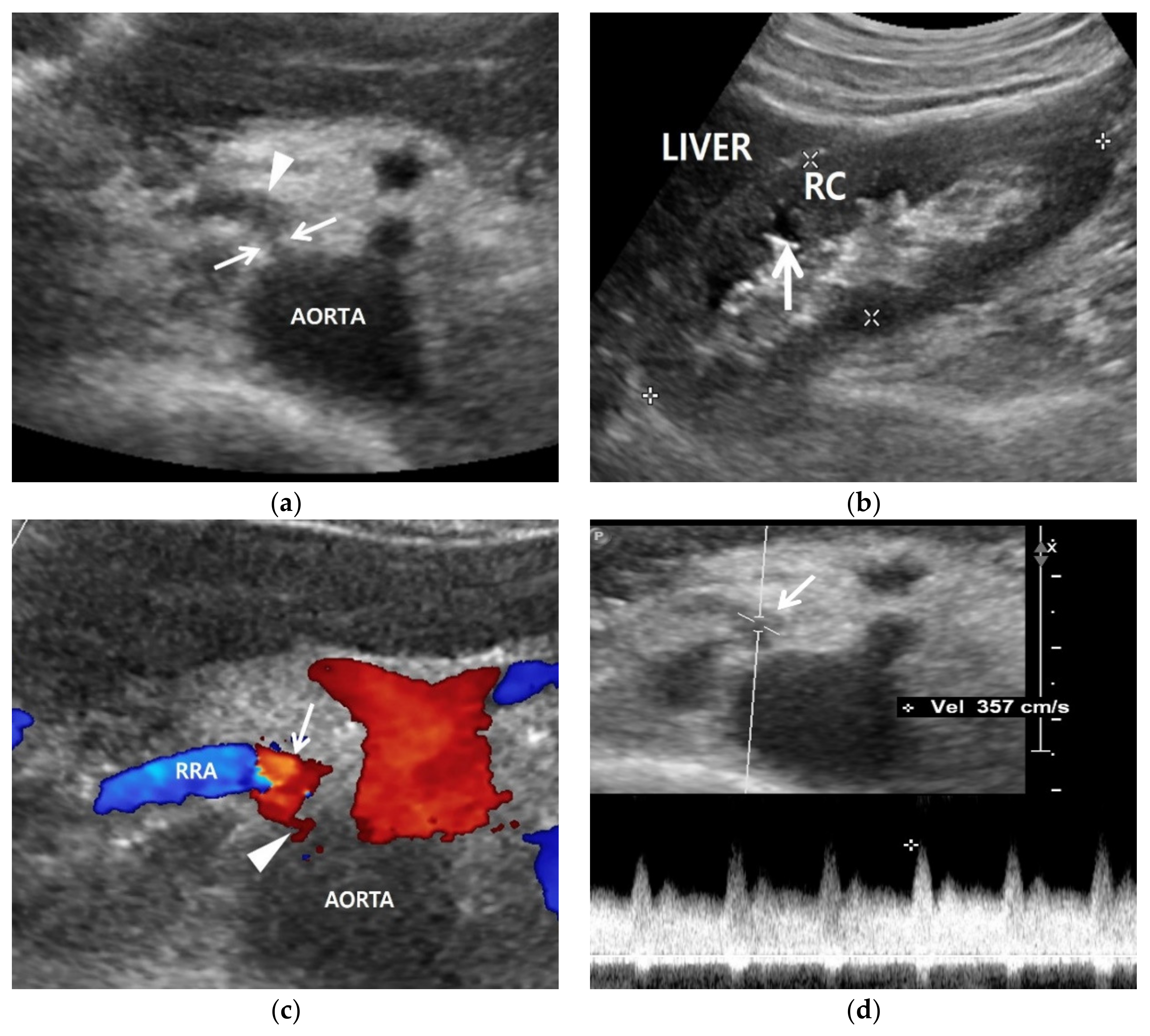 Jcm 11 03961 g002 Jcm 11 03961 g002