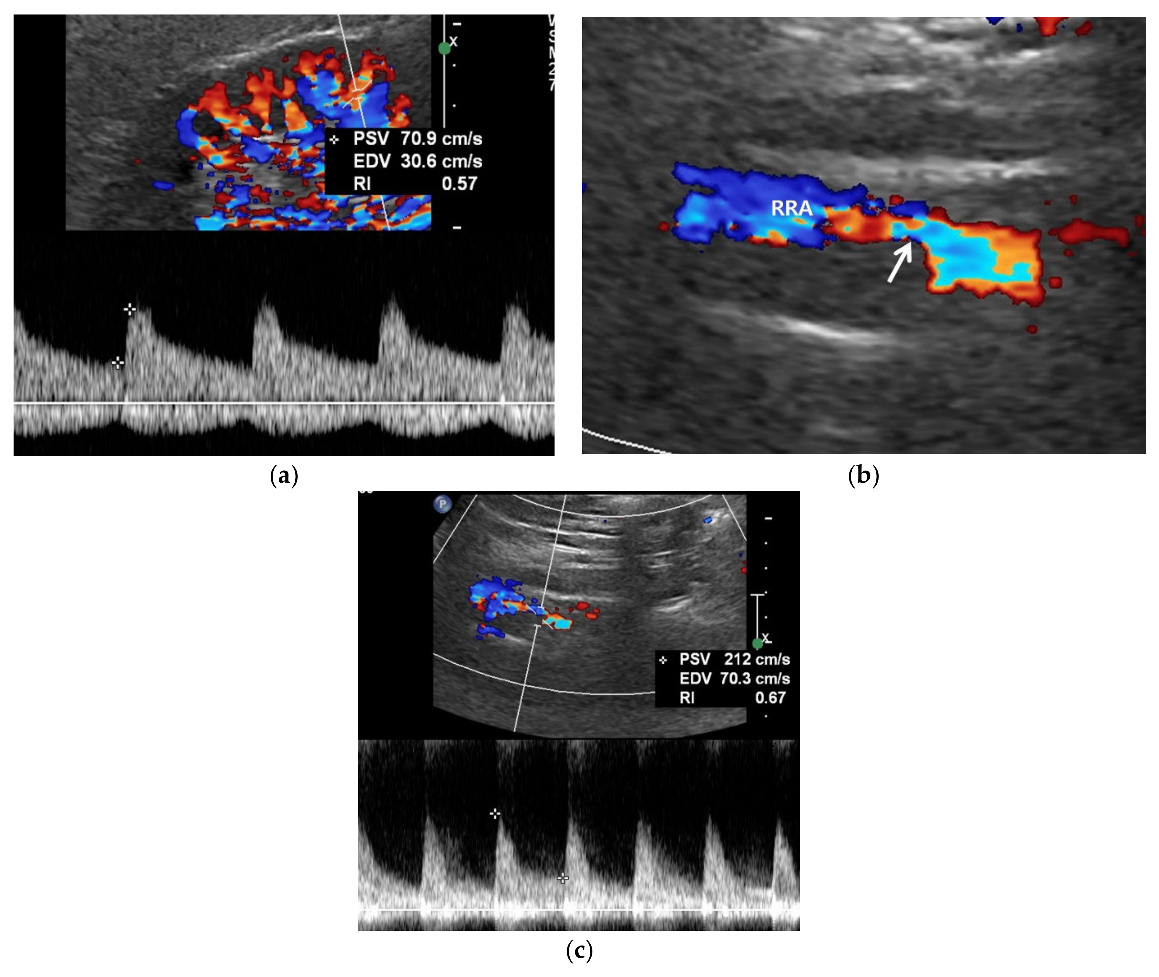 Jcm 11 03961 g003 Jcm 11 03961 g003