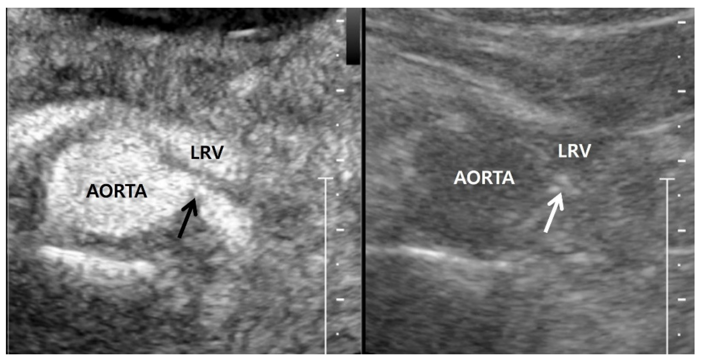 Jcm 11 03961 g005 Jcm 11 03961 g005