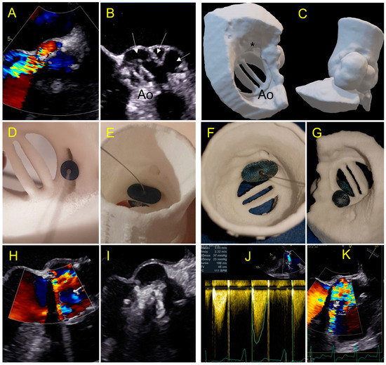 Jcm 11 04758 g007 550