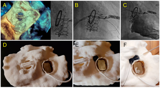Jcm 11 04758 g009 550