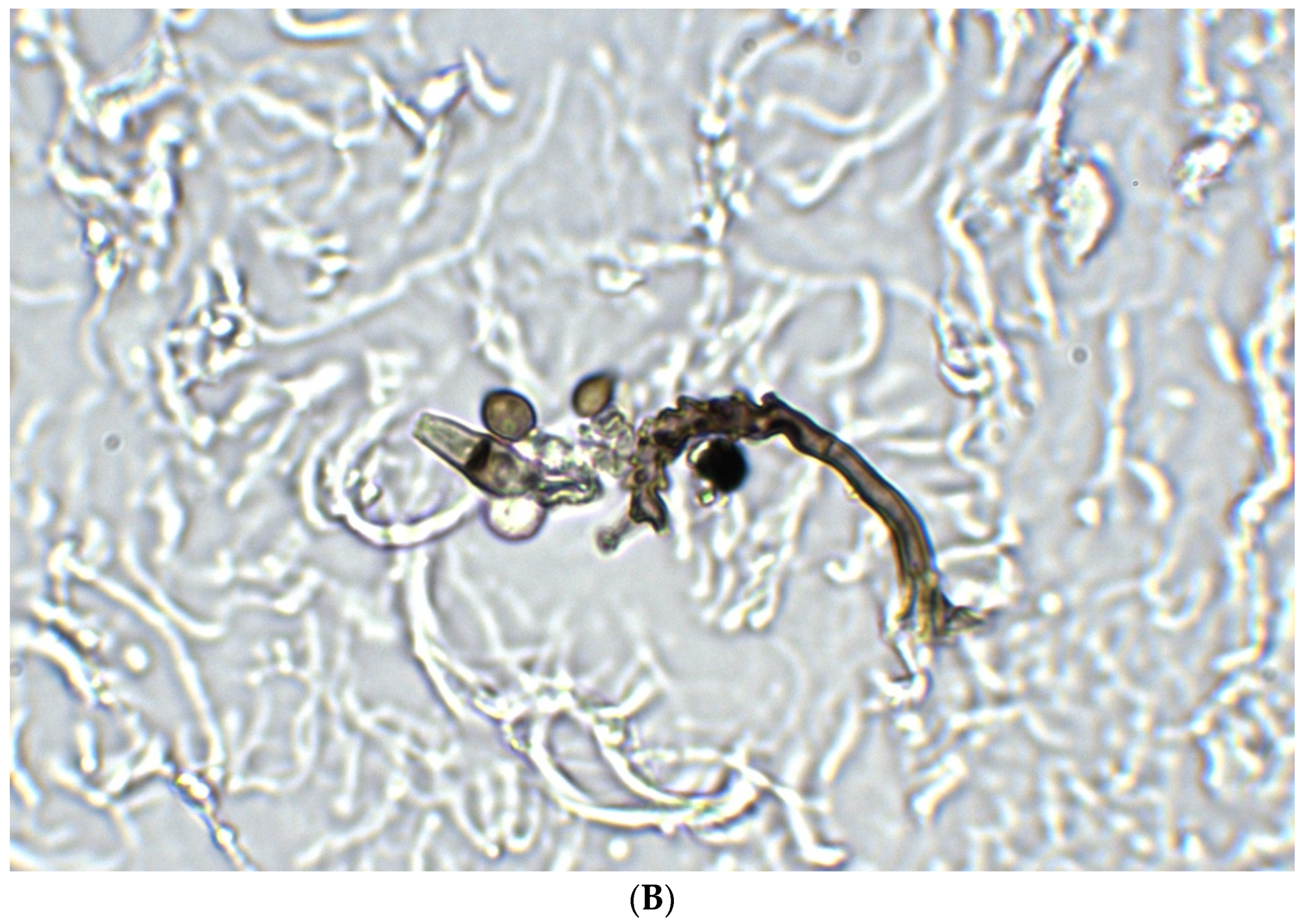 Jcm 11 05393 g006b