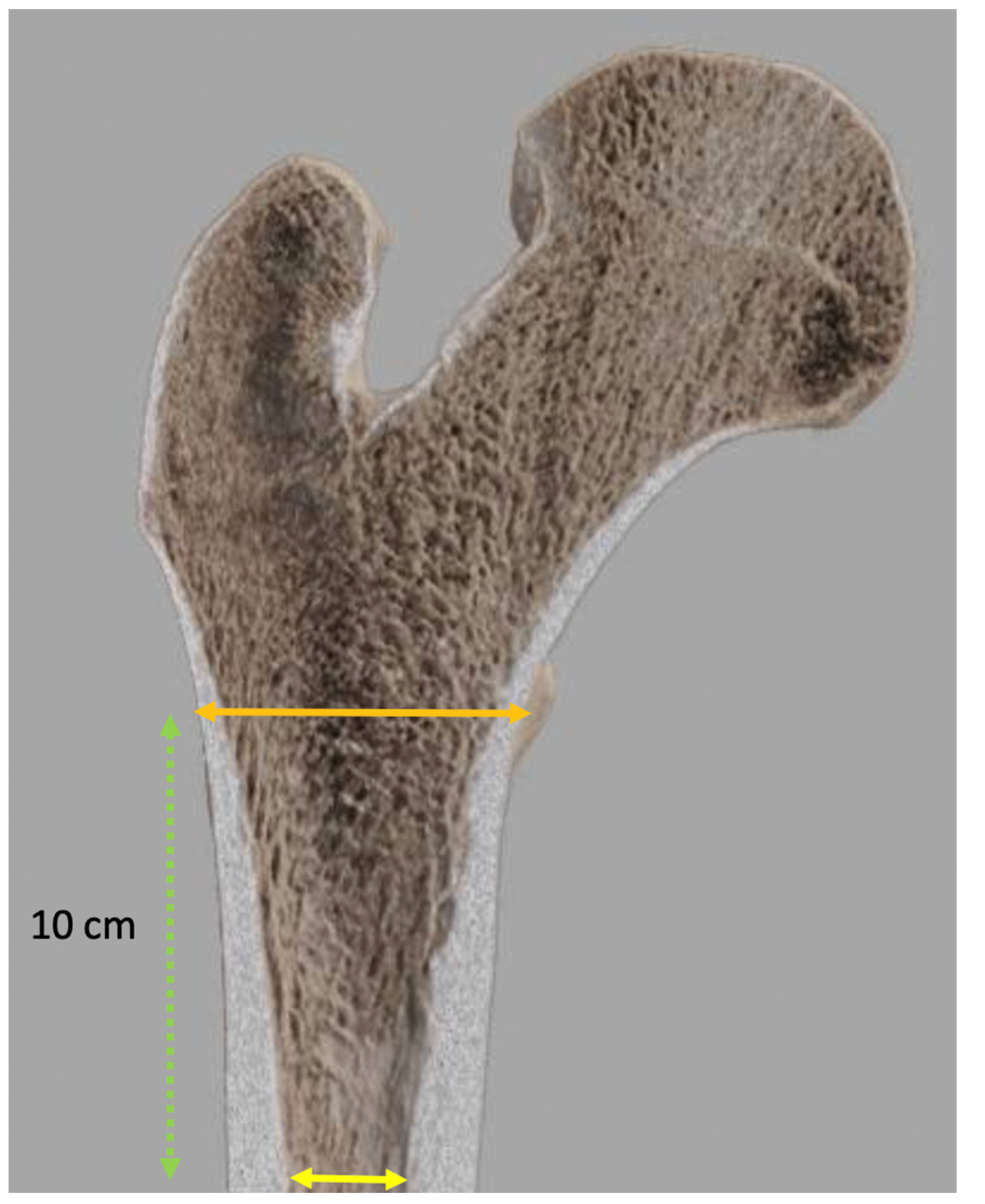 Jcm 11 05465 g006 Jcm 11 05465 g006