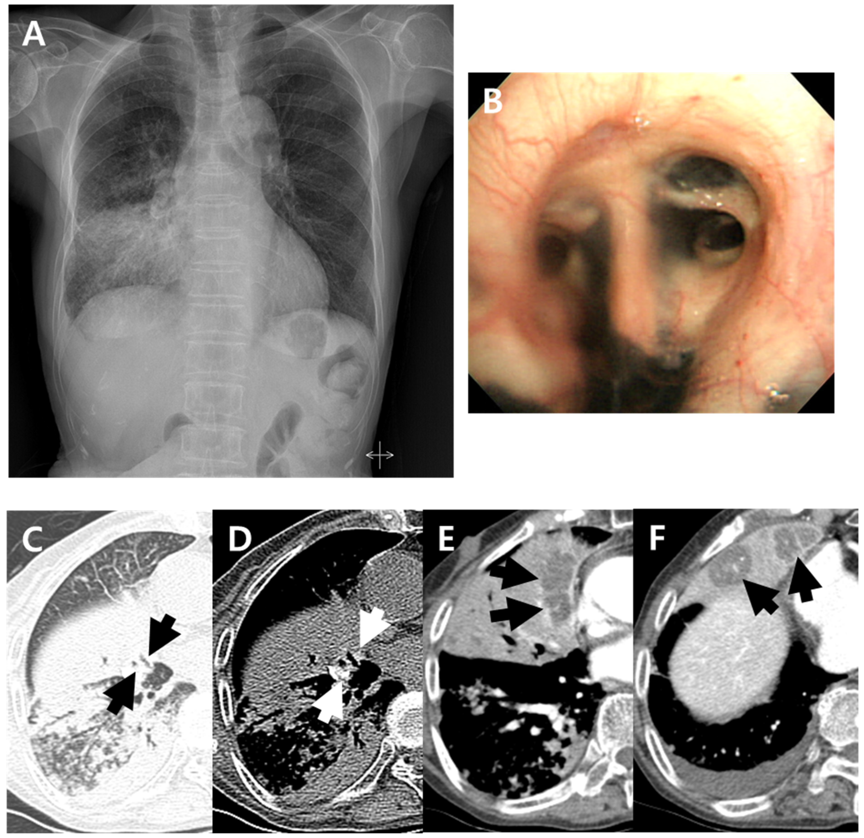 Jcm 11 05646 g001 Jcm 11 05646 g001