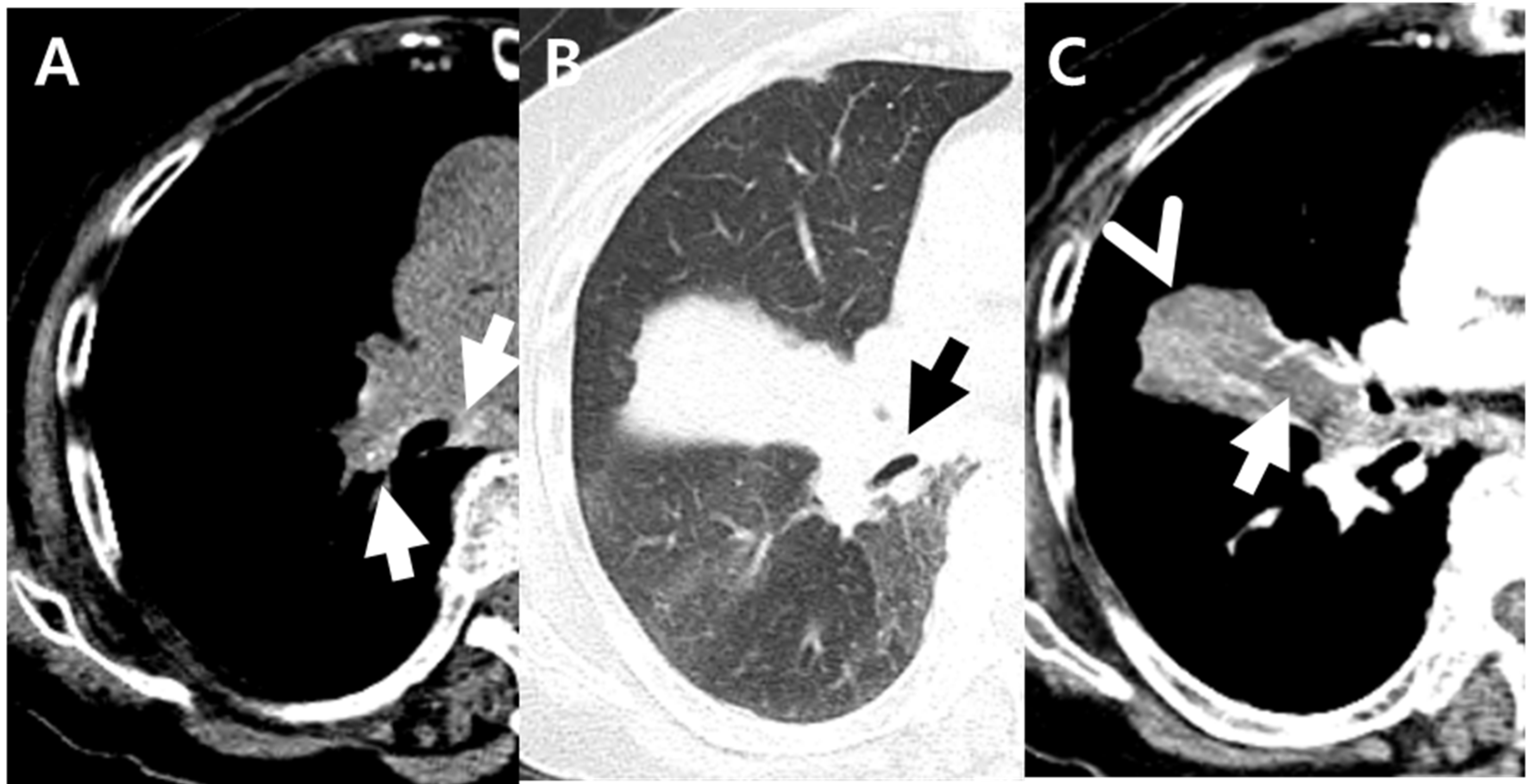 Jcm 11 05646 g002 Jcm 11 05646 g002