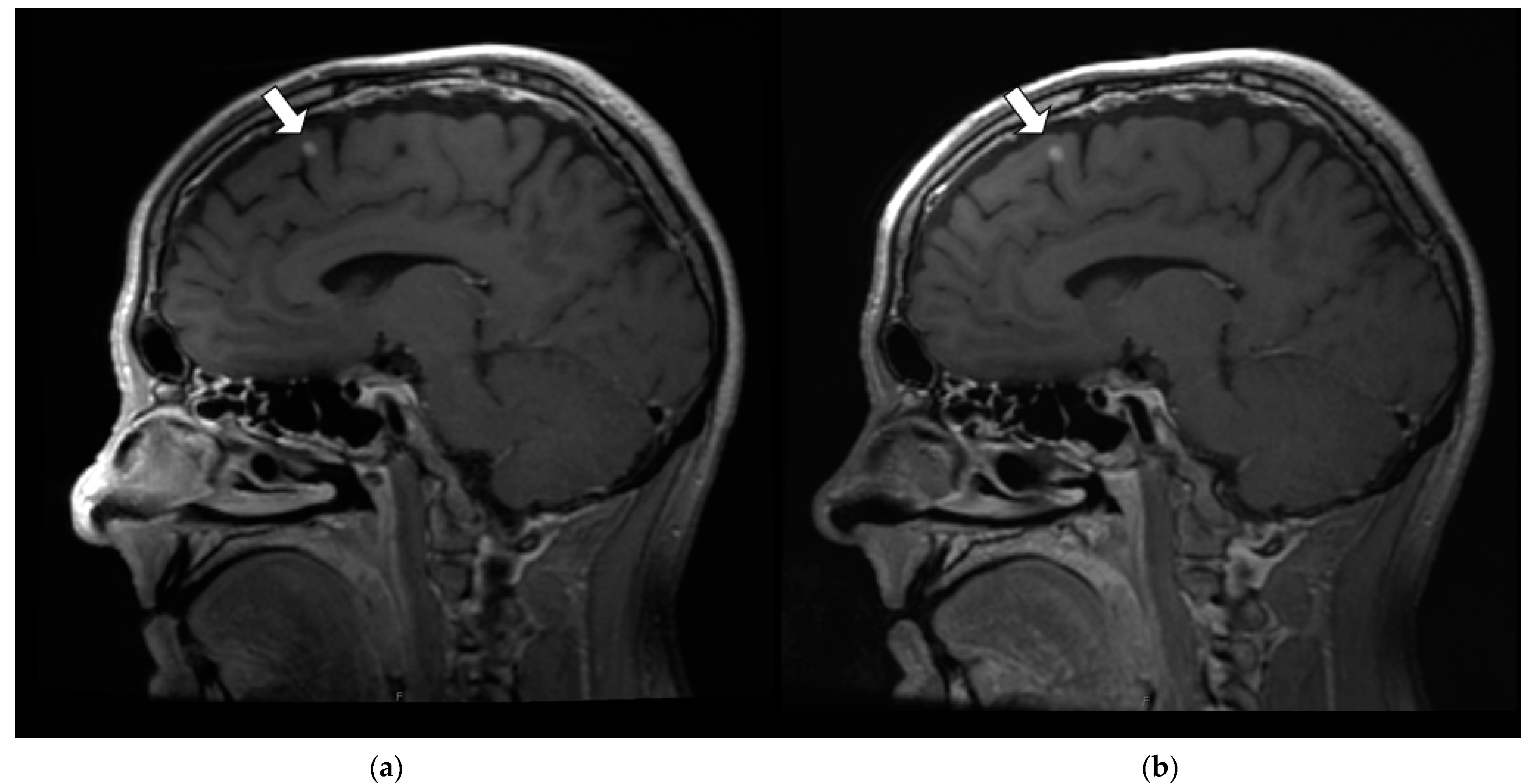 Jcm 11 05984 g007 Jcm 11 05984 g007