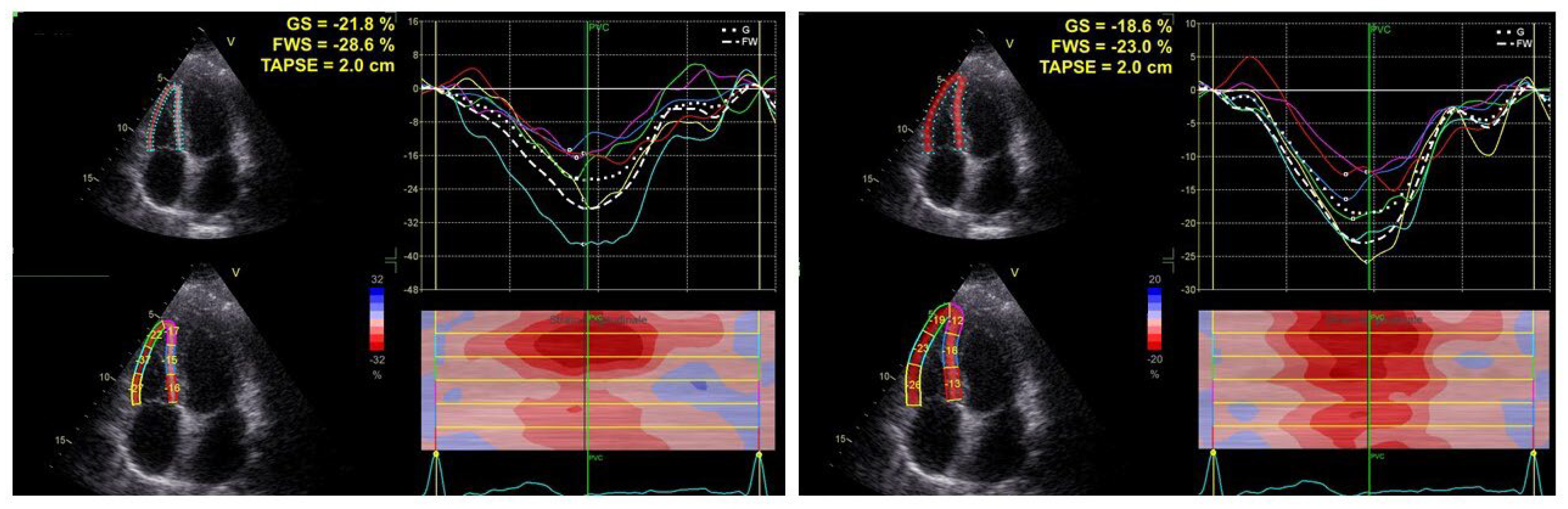 Jcm 11 06115 g001 Jcm 11 06115 g001