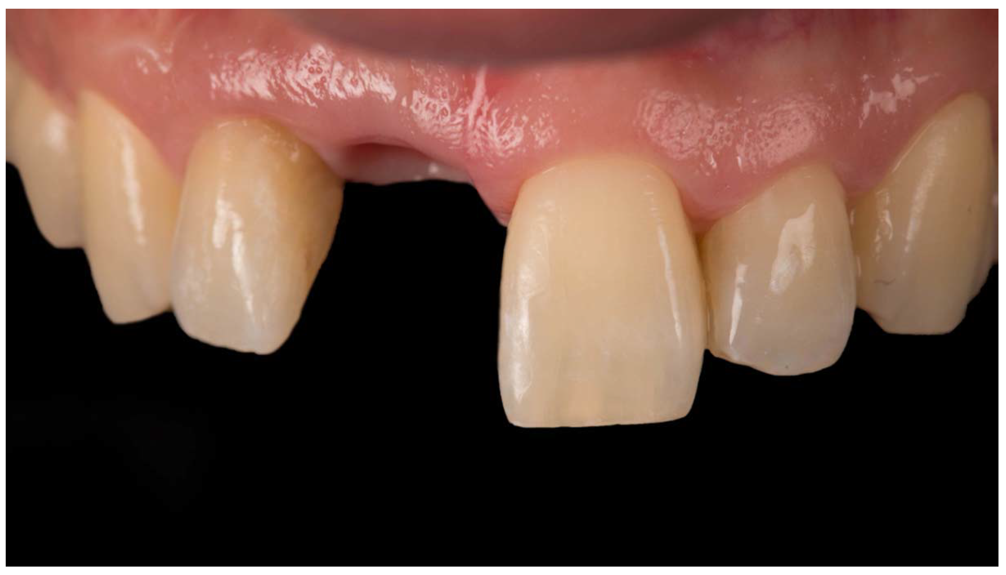 Jcm 11 06243 g006 Jcm 11 06243 g006