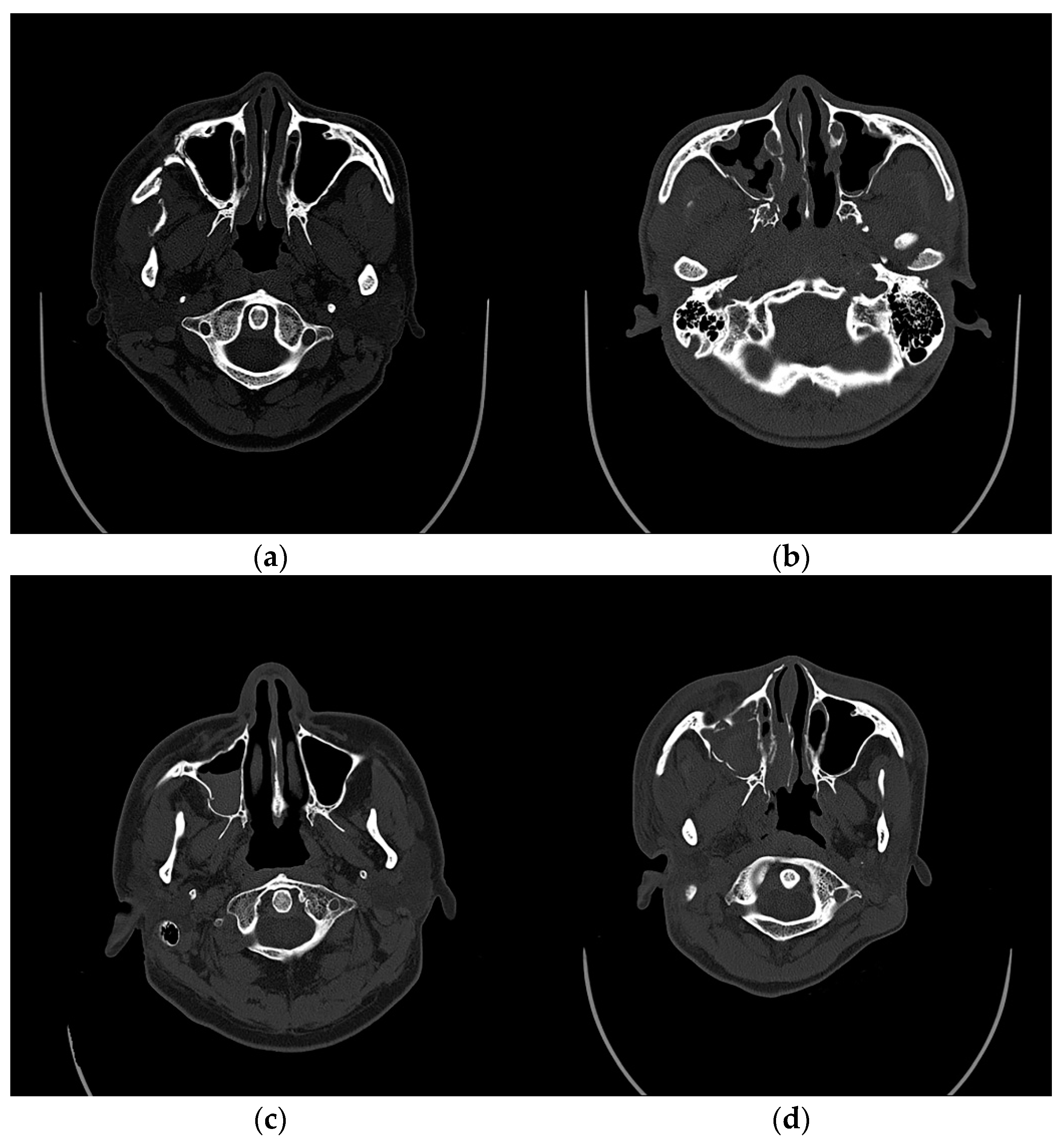 Jcm 11 06299 g001 Jcm 11 06299 g001