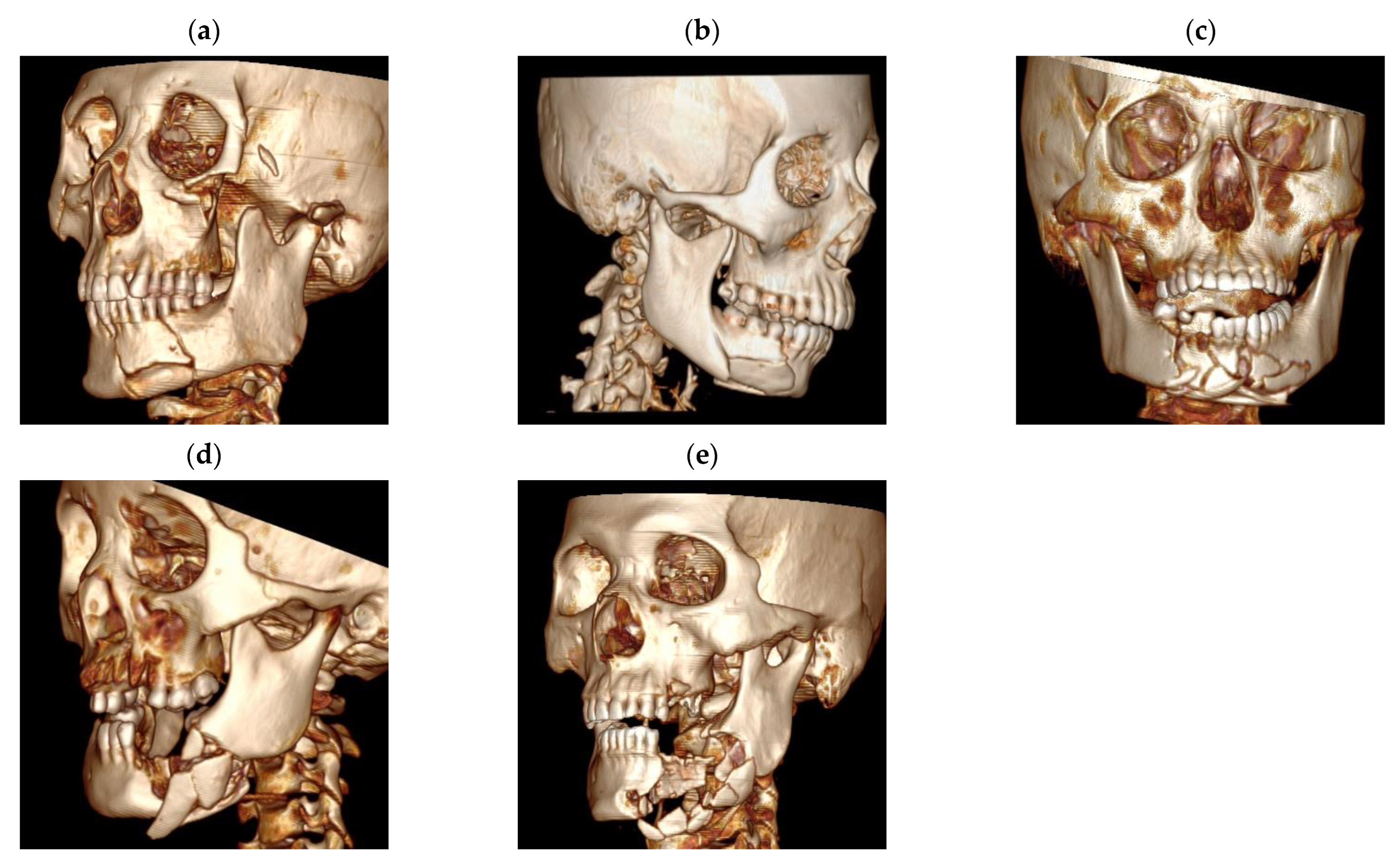 Jcm 11 06301 g001 Jcm 11 06301 g001