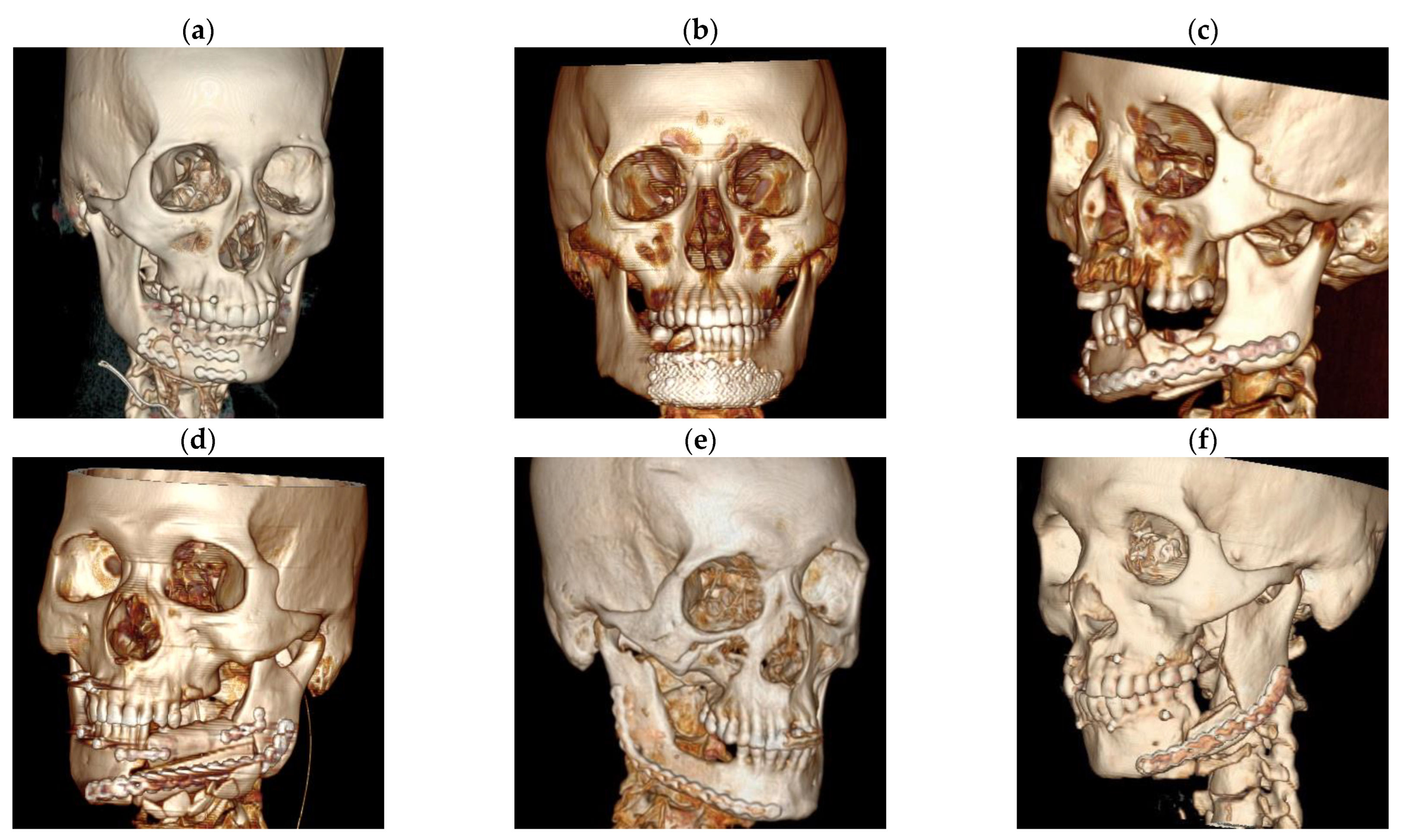 Jcm 11 06301 g002 Jcm 11 06301 g002