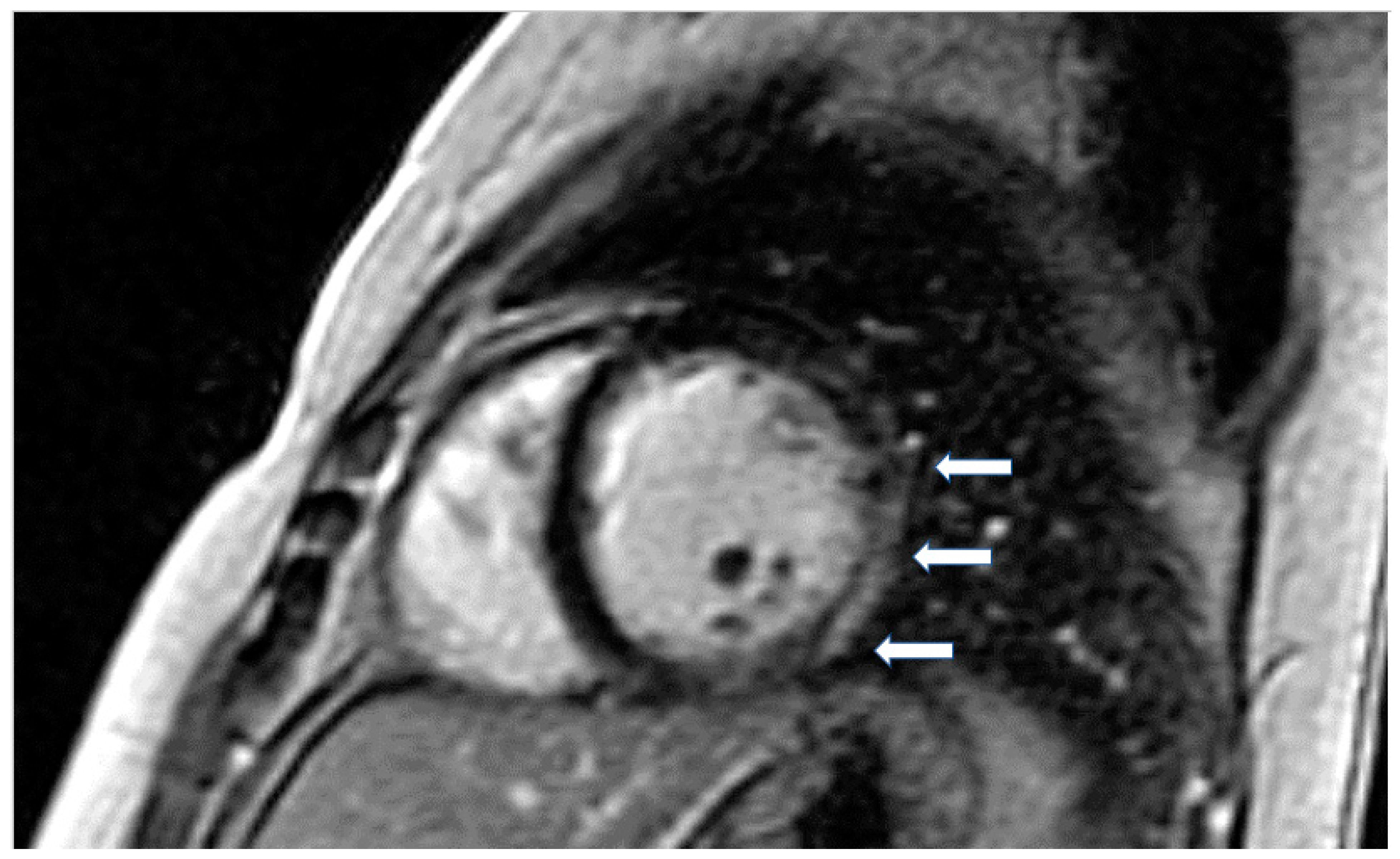 Jcm 11 06403 g003 Jcm 11 06403 g003