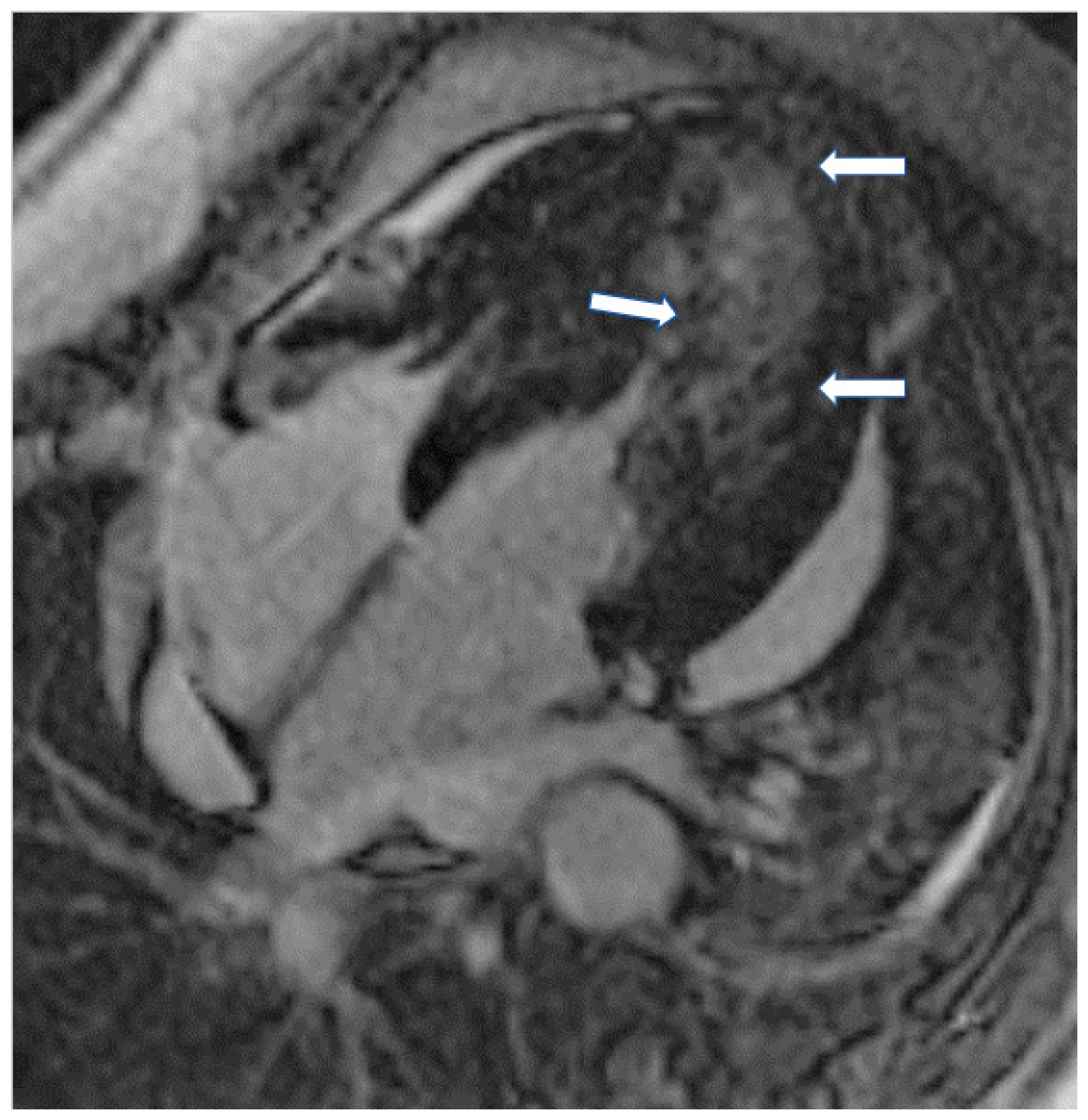 Jcm 11 06403 g004 Jcm 11 06403 g004