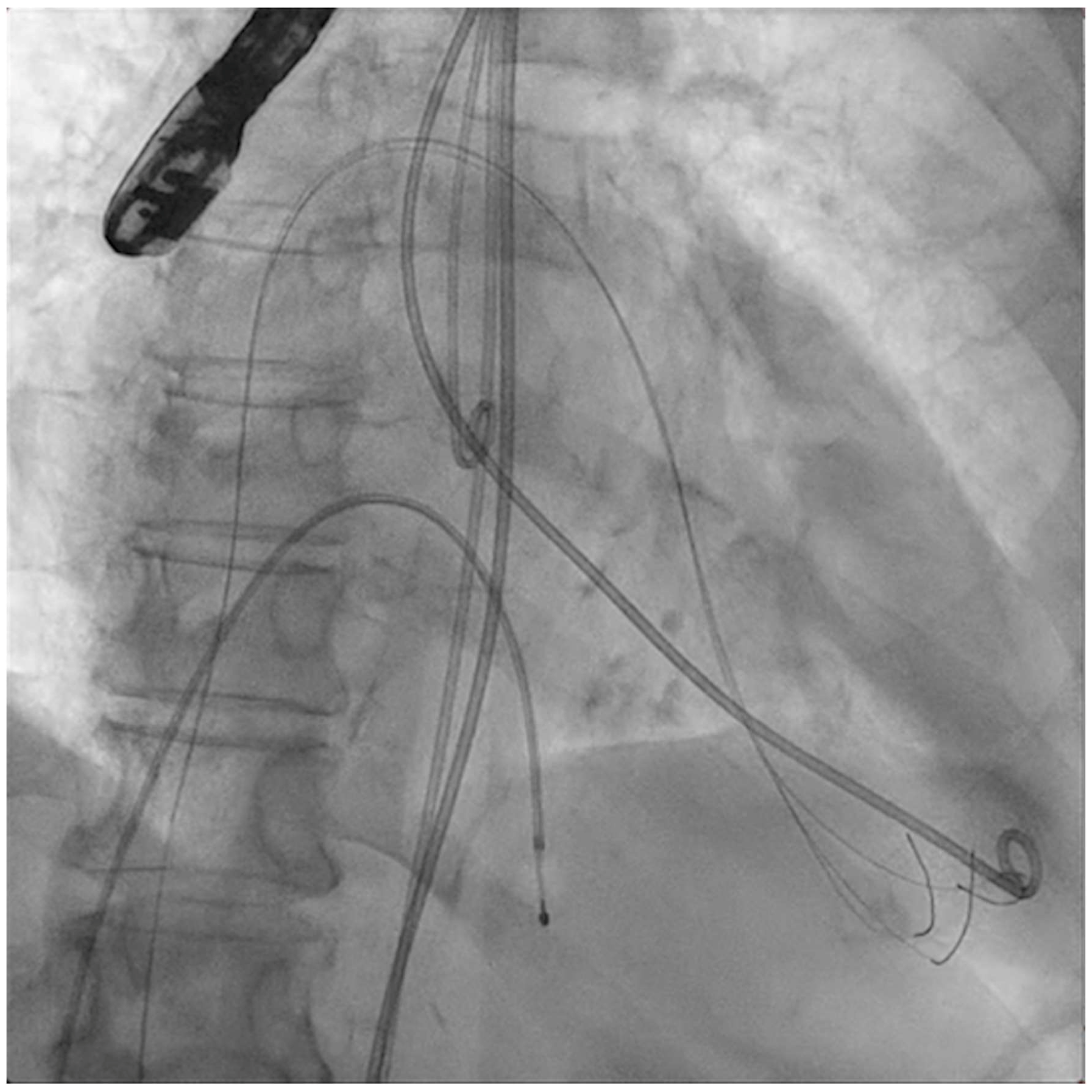 Jcm 11 06444 g002 Jcm 11 06444 g002