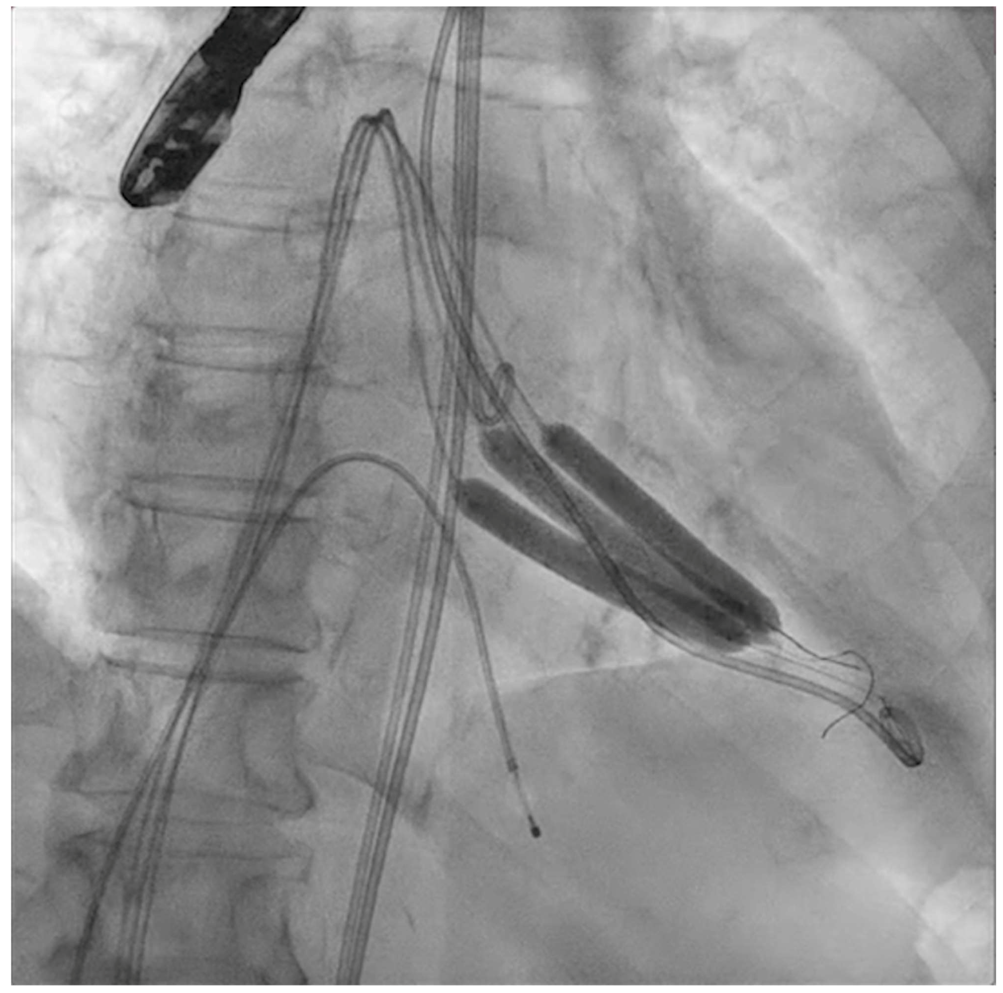 Jcm 11 06444 g003 Jcm 11 06444 g003