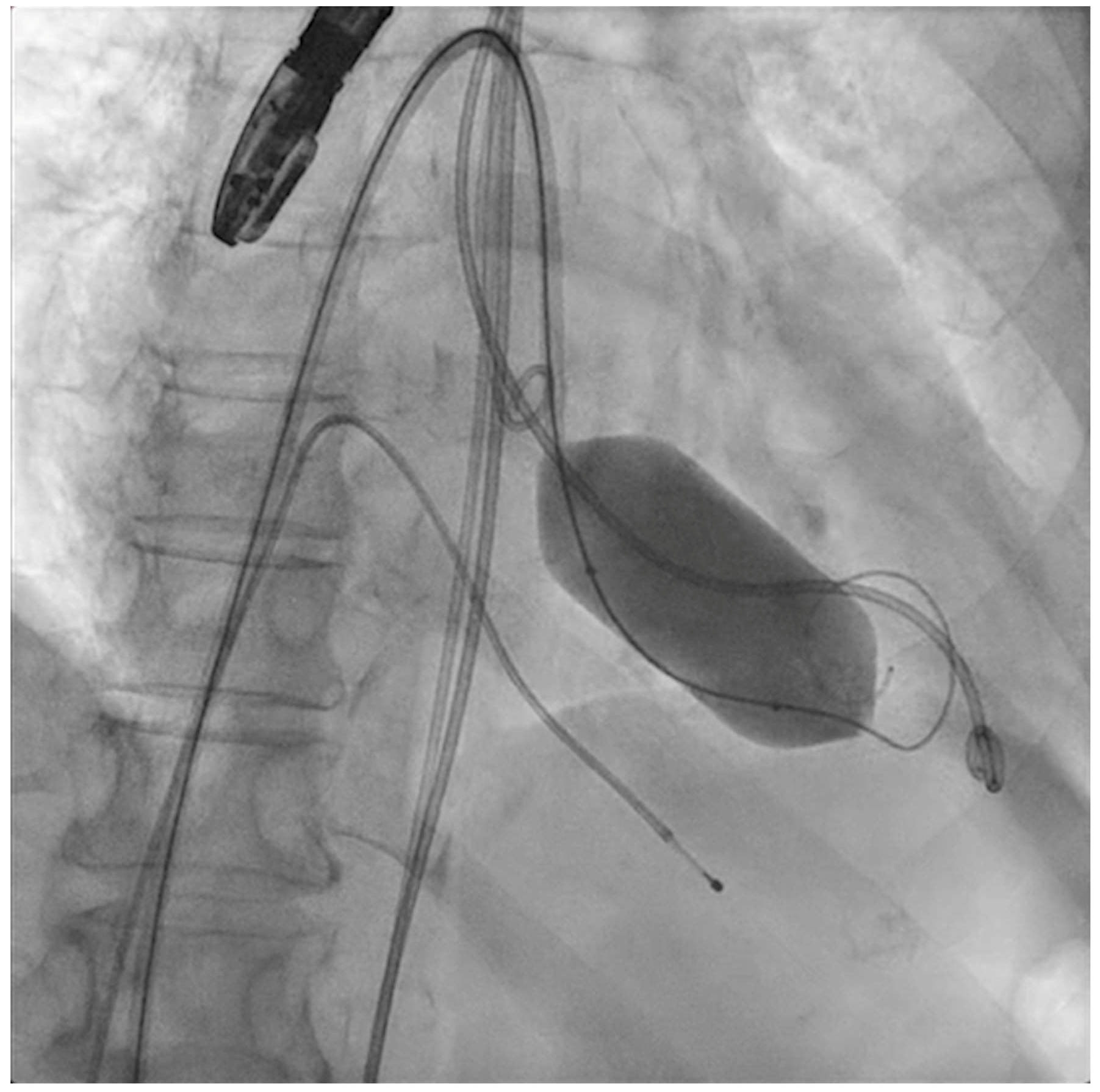 Jcm 11 06444 g004 Jcm 11 06444 g004