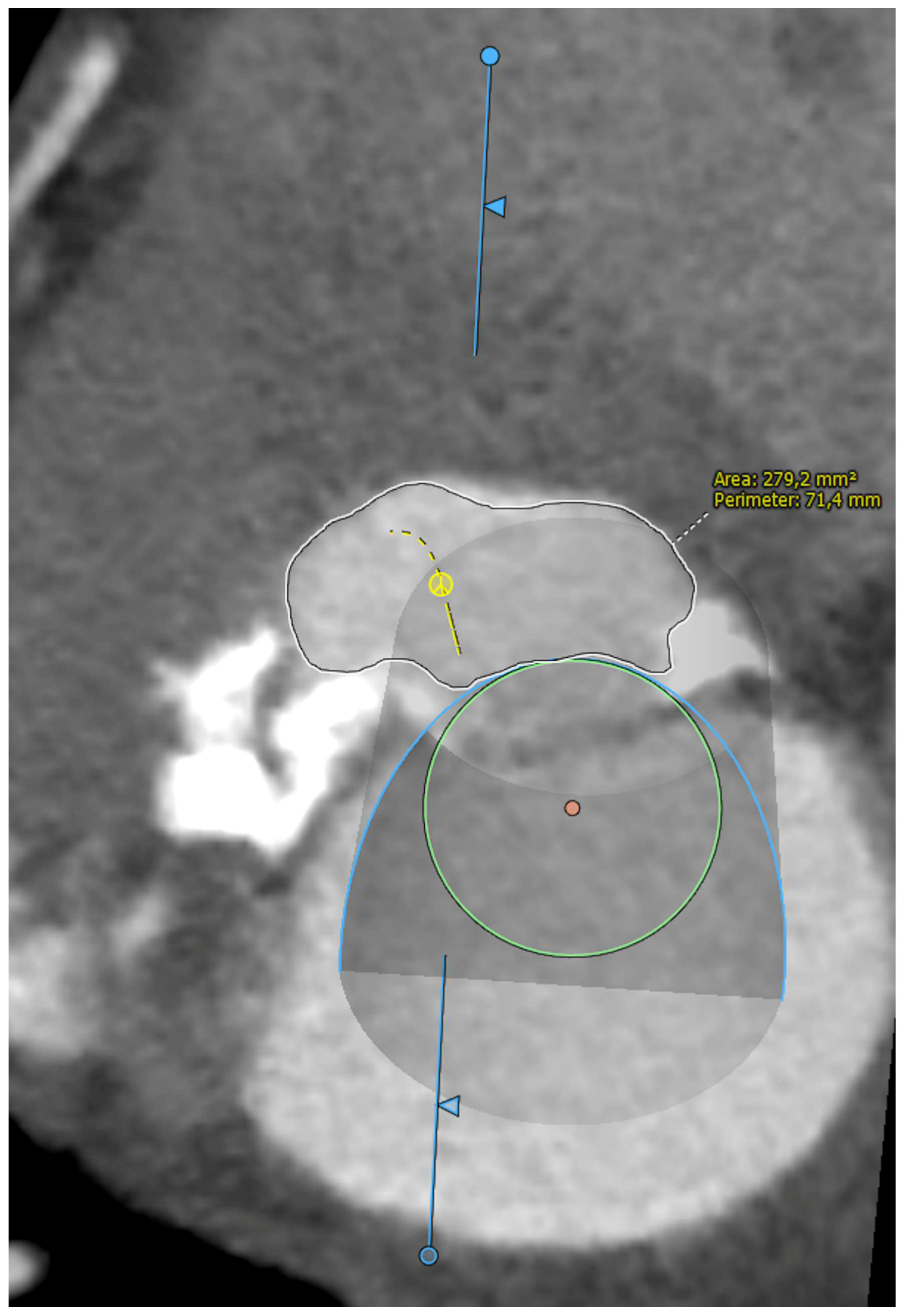 Jcm 11 06444 g006 Jcm 11 06444 g006