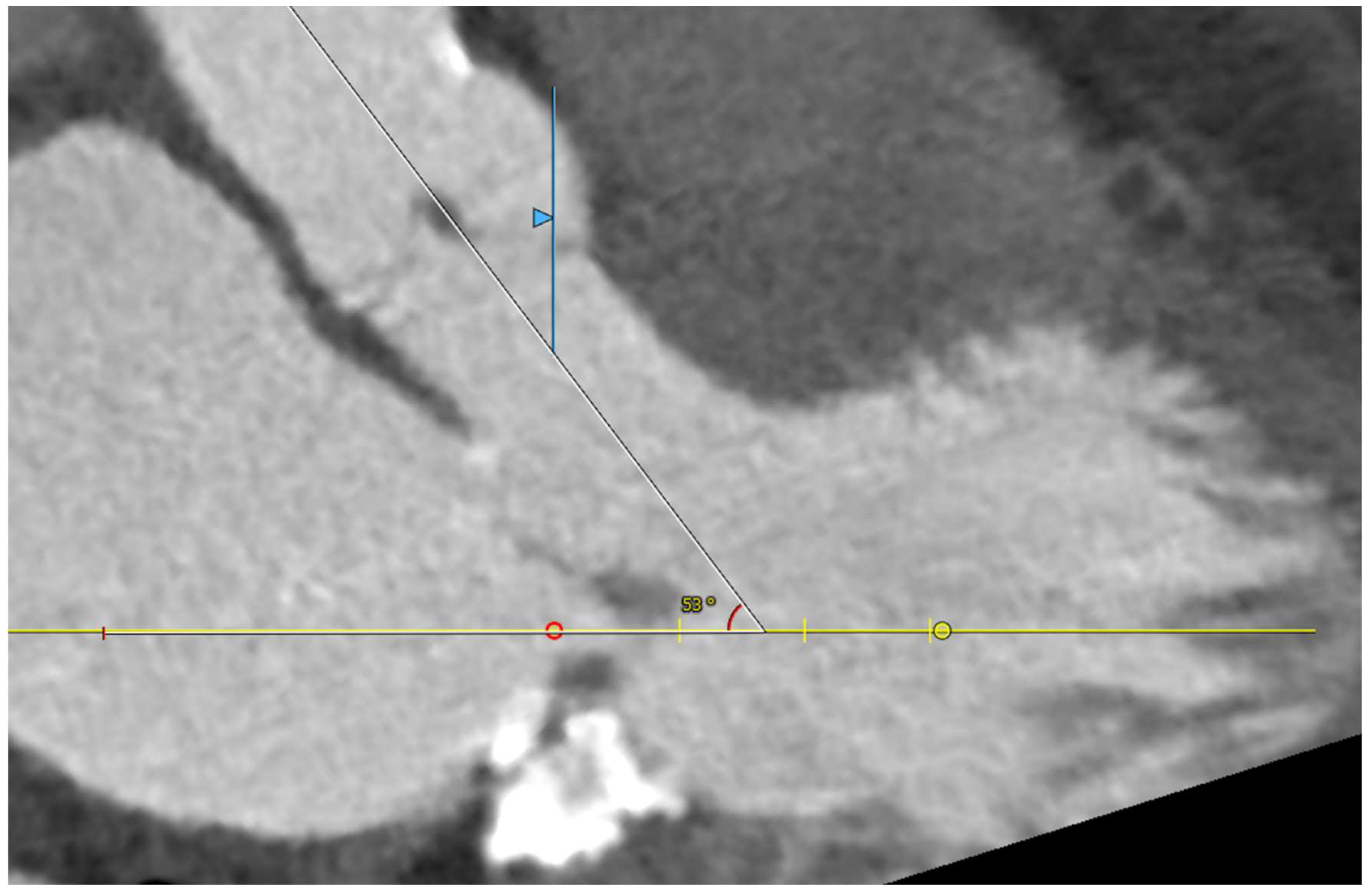 Jcm 11 06444 g007 Jcm 11 06444 g007