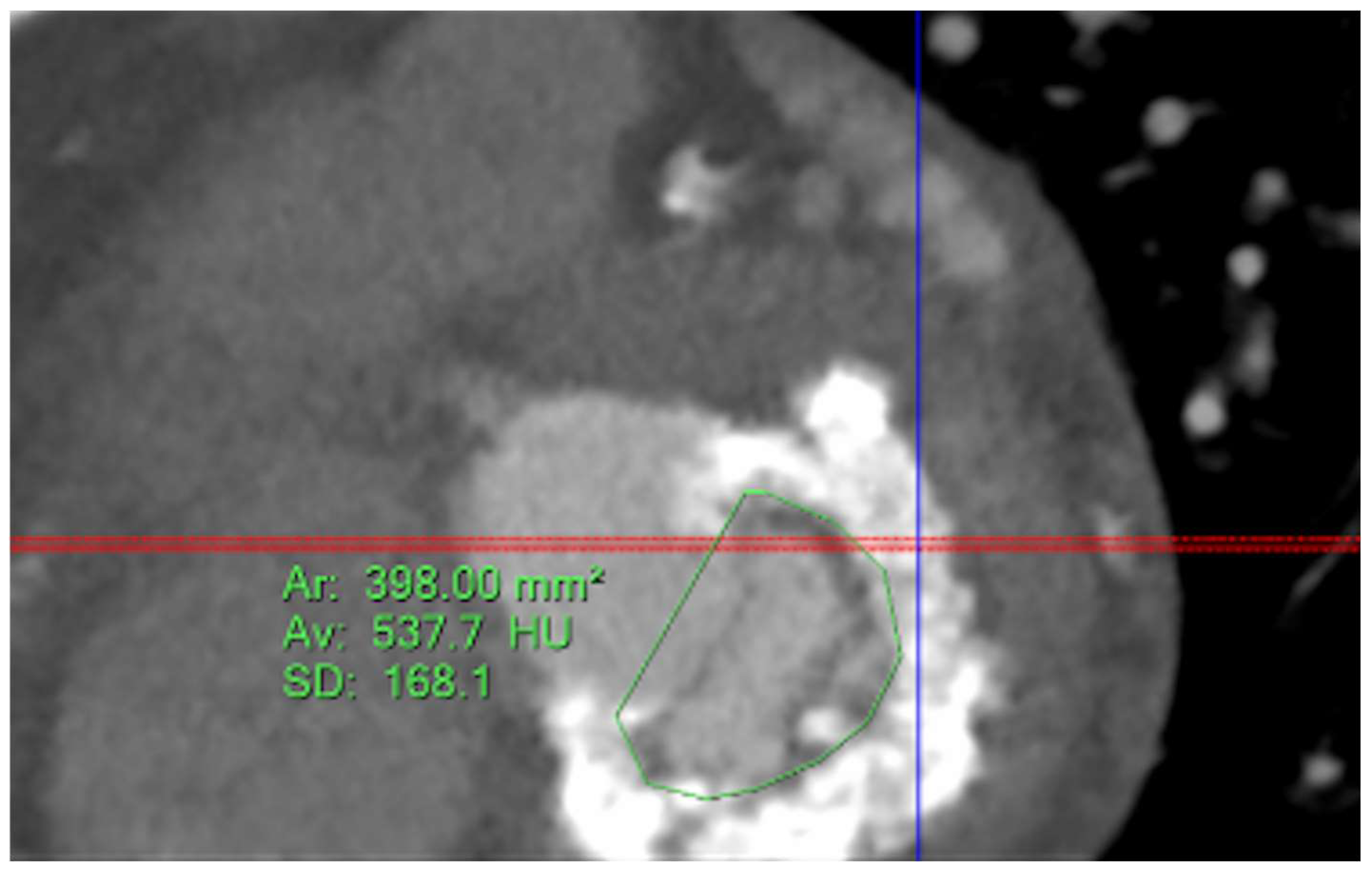 Jcm 11 06444 g008 Jcm 11 06444 g008