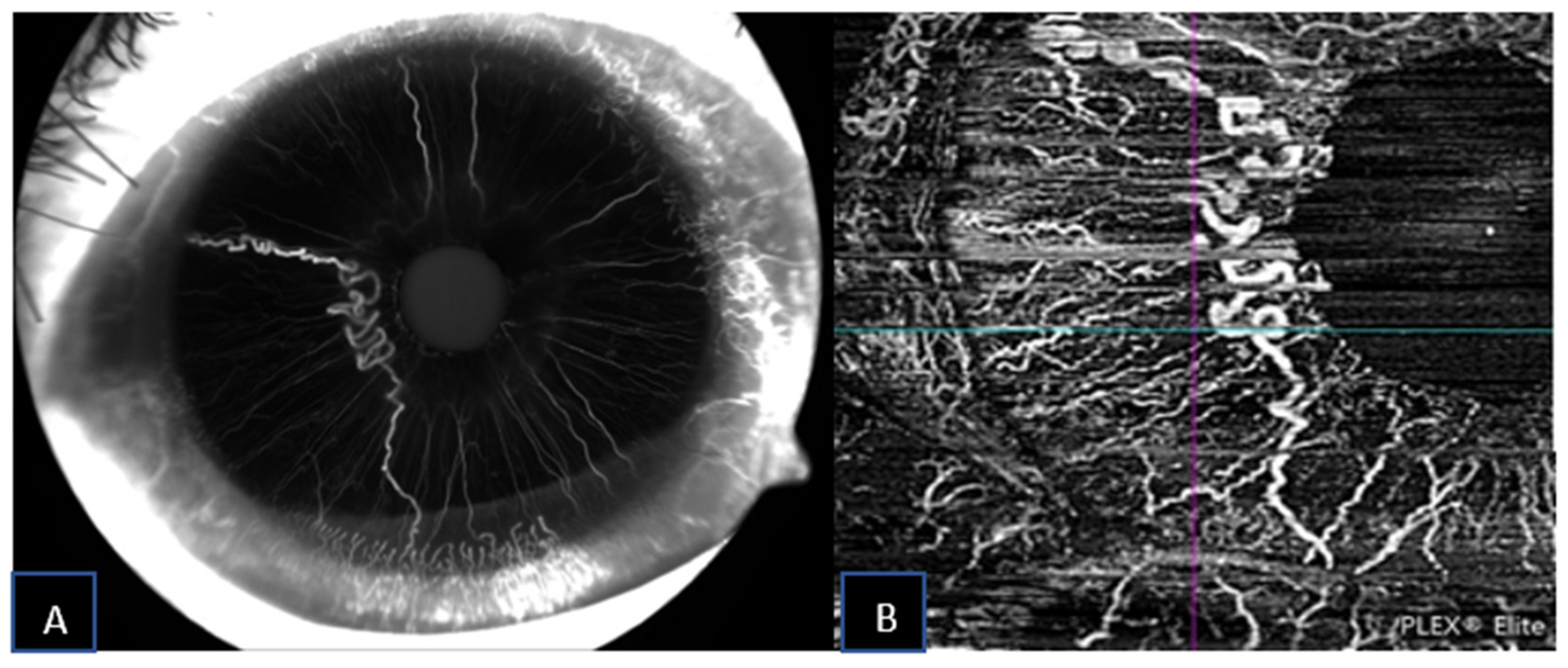 Jcm 11 06575 g004 Jcm 11 06575 g004