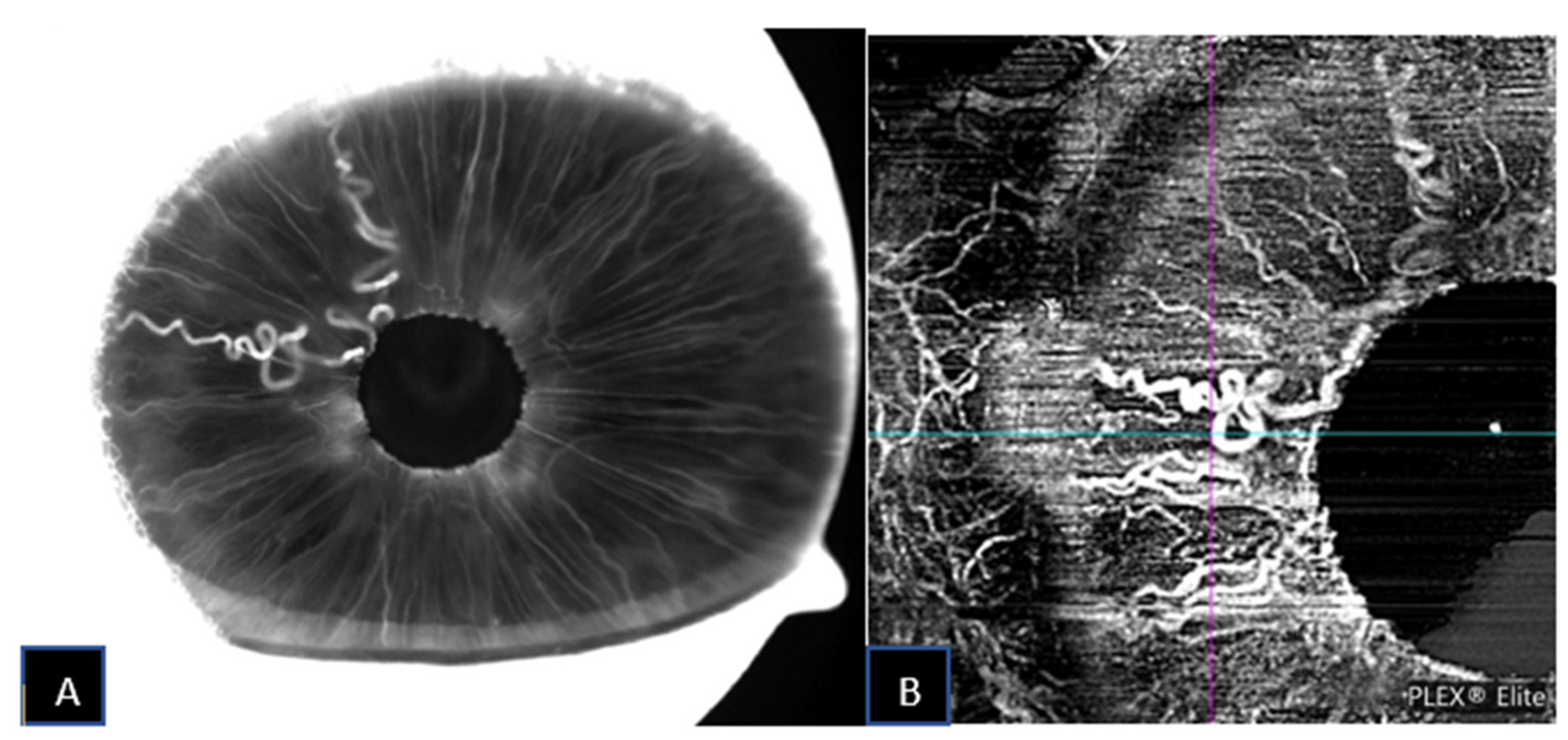 Jcm 11 06575 g006 Jcm 11 06575 g006