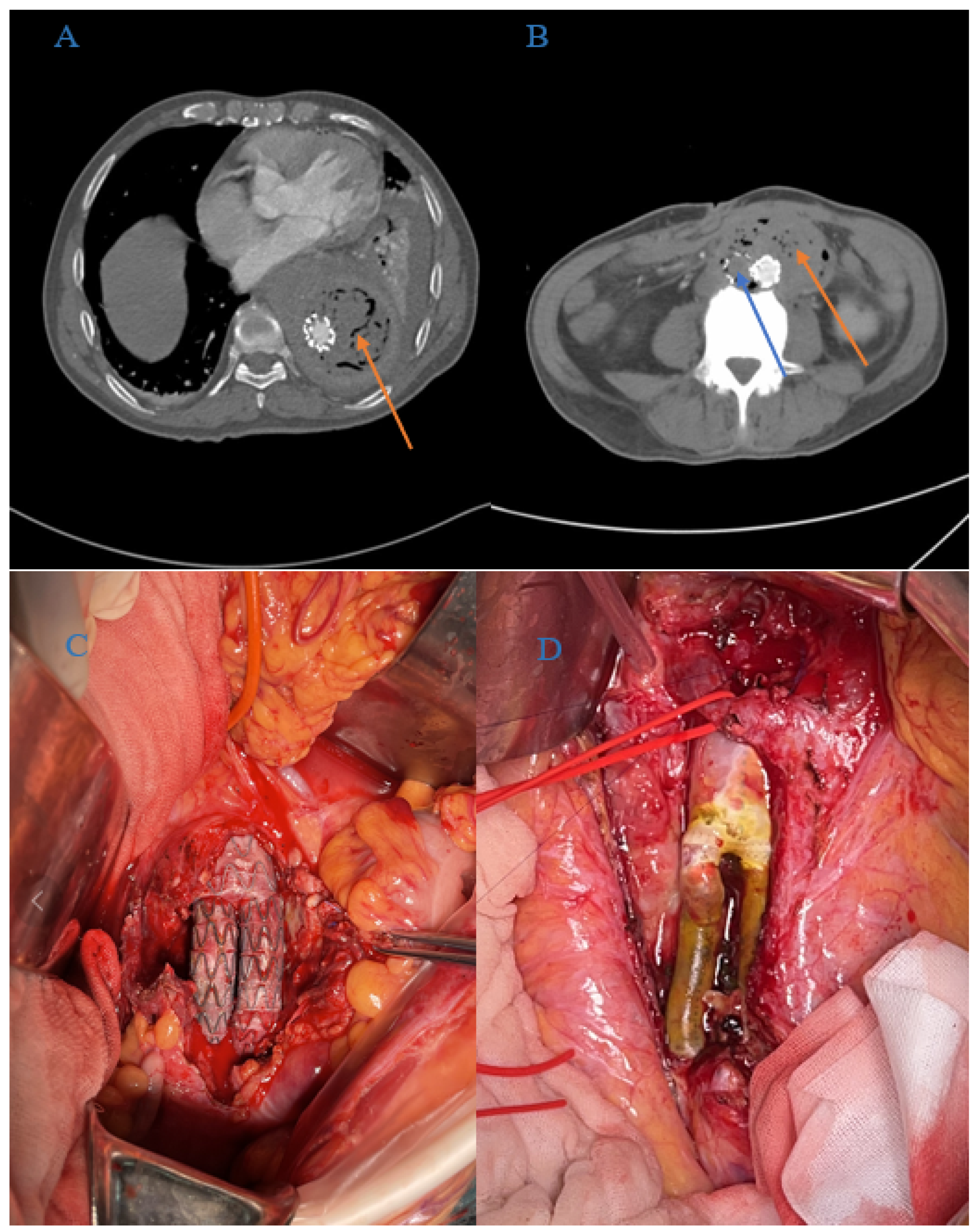 Jcm 11 06588 g002 Jcm 11 06588 g002