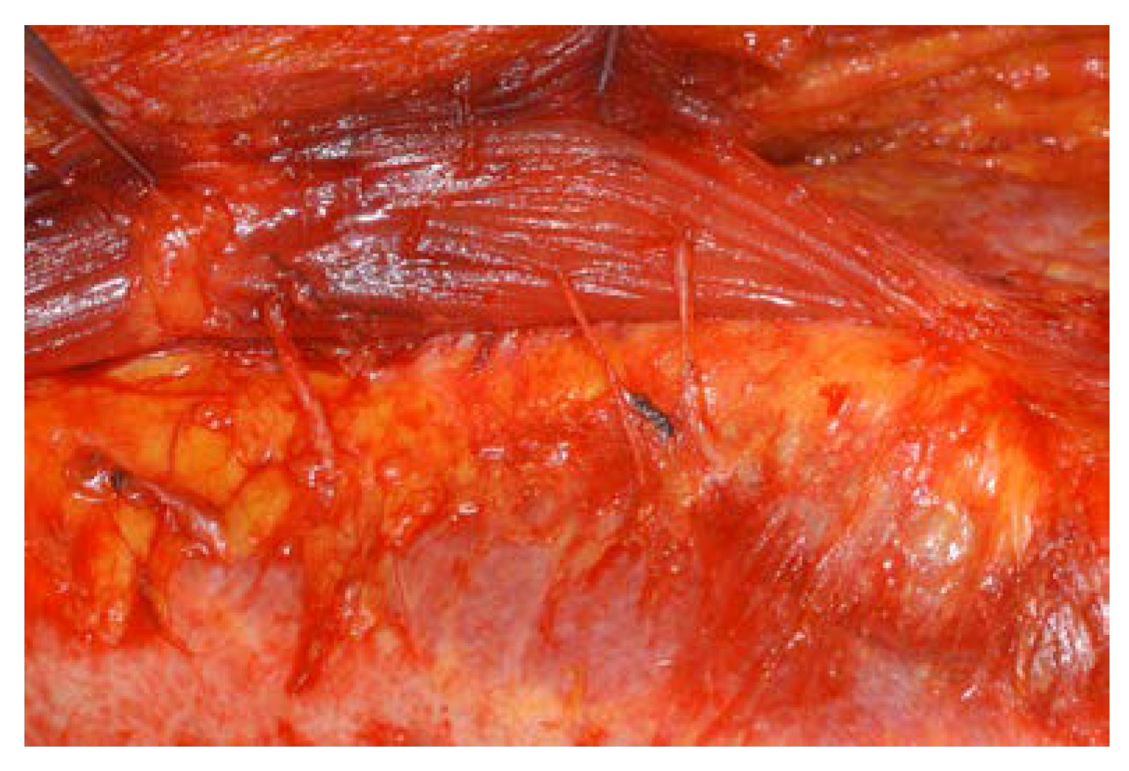 Jcm 11 06647 g004