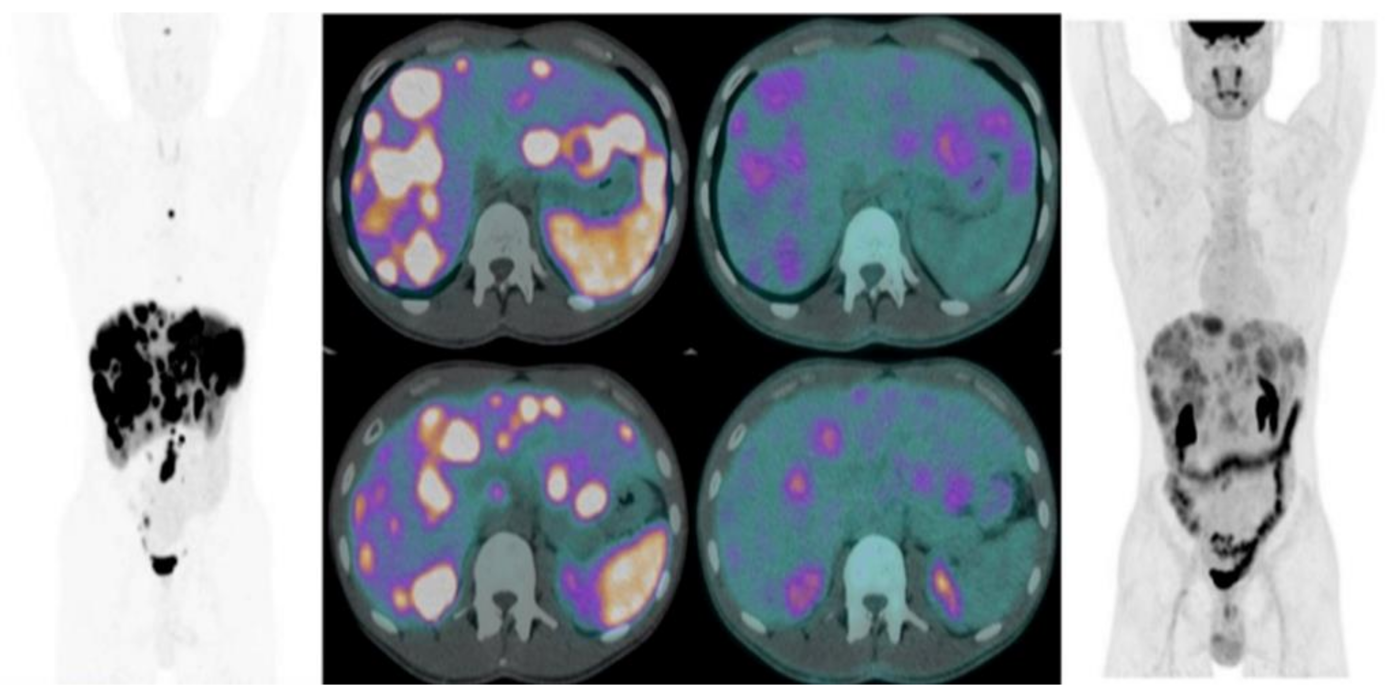 Jcm 11 06836 g003 Jcm 11 06836 g003