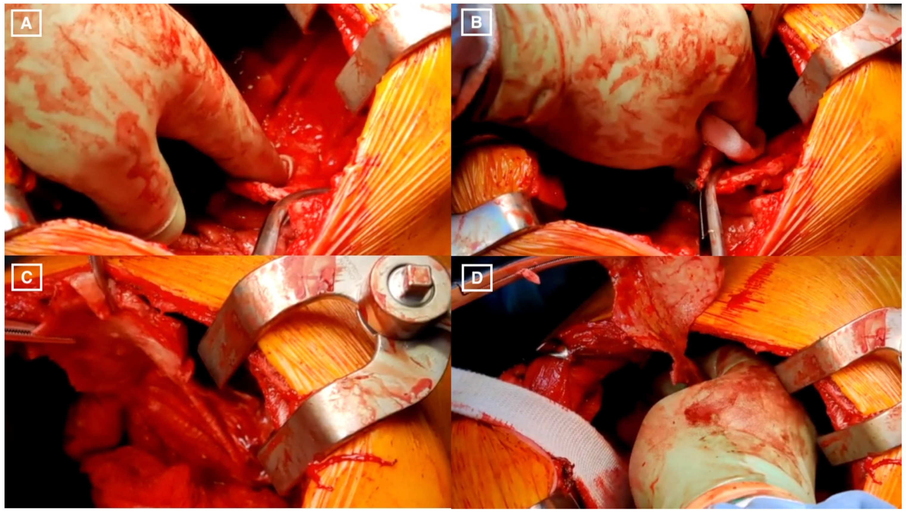 Jcm 11 06839 g001 Jcm 11 06839 g001