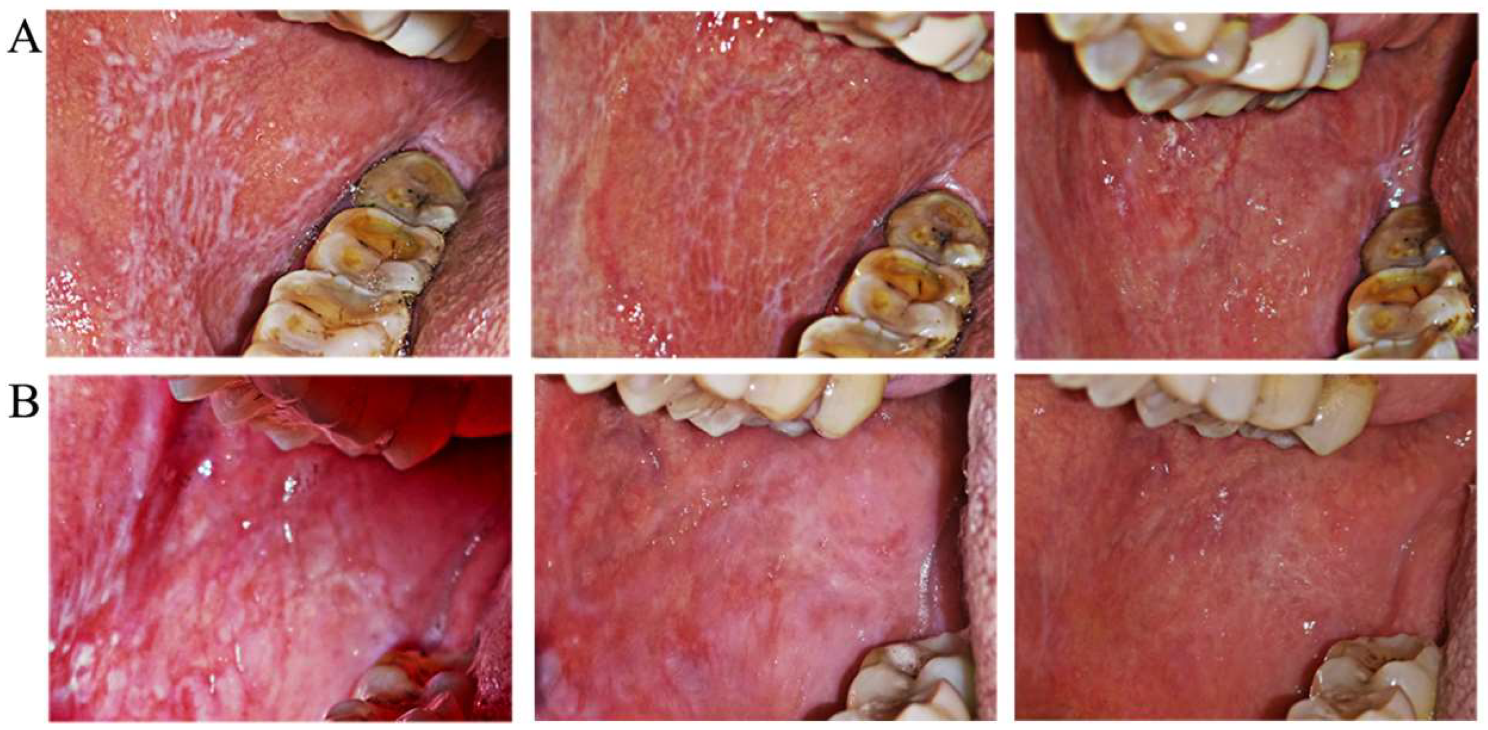 Jcm 11 07004 g004 Jcm 11 07004 g004