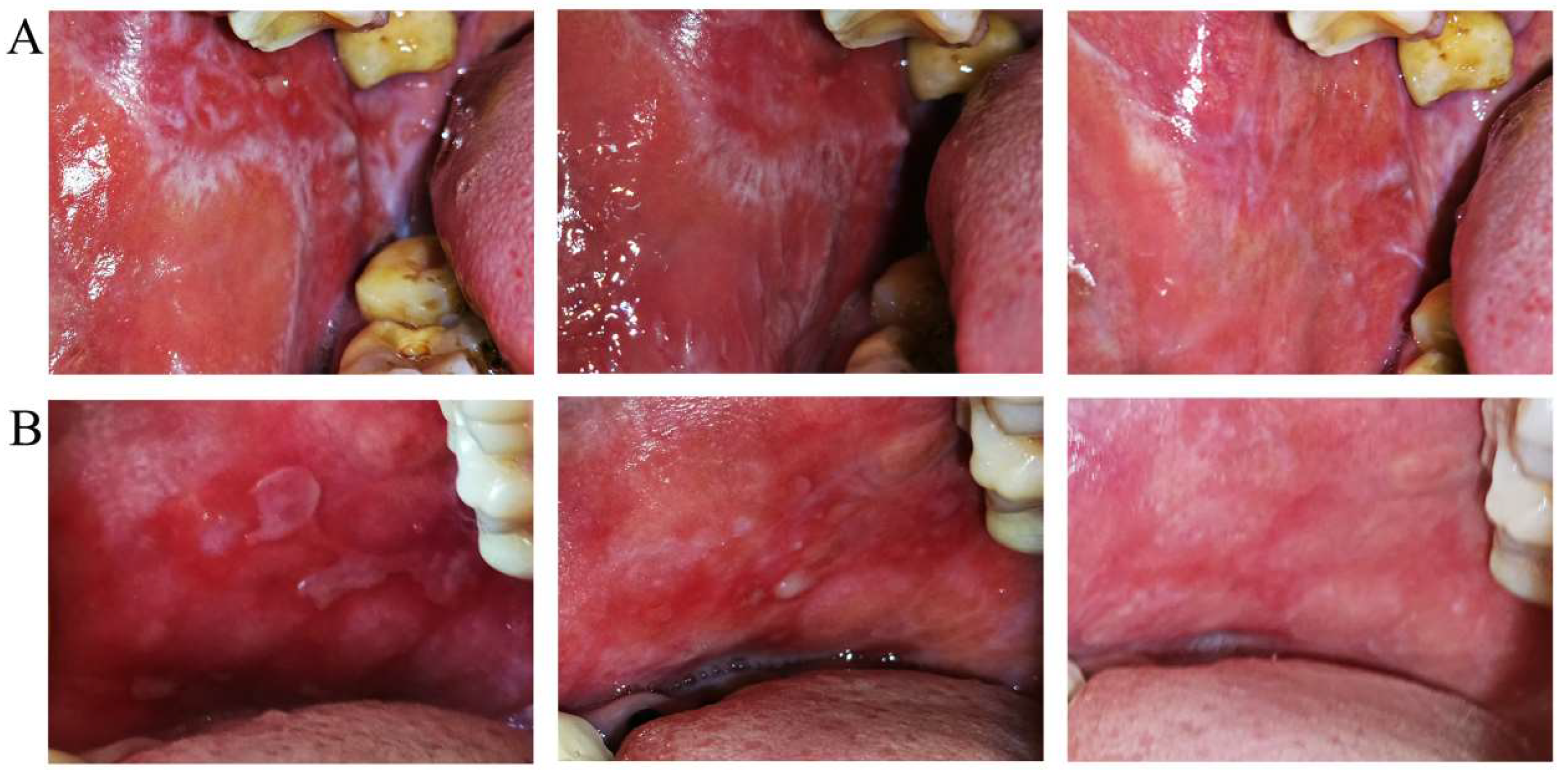 Jcm 11 07004 g006 Jcm 11 07004 g006