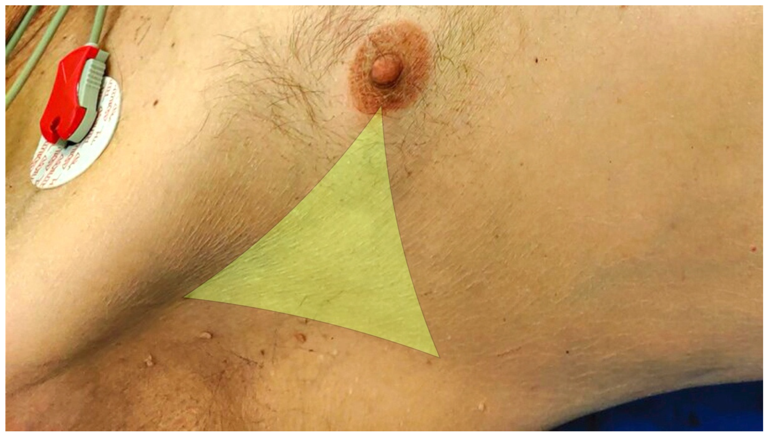 Jcm 11 07315 g003 Jcm 11 07315 g003