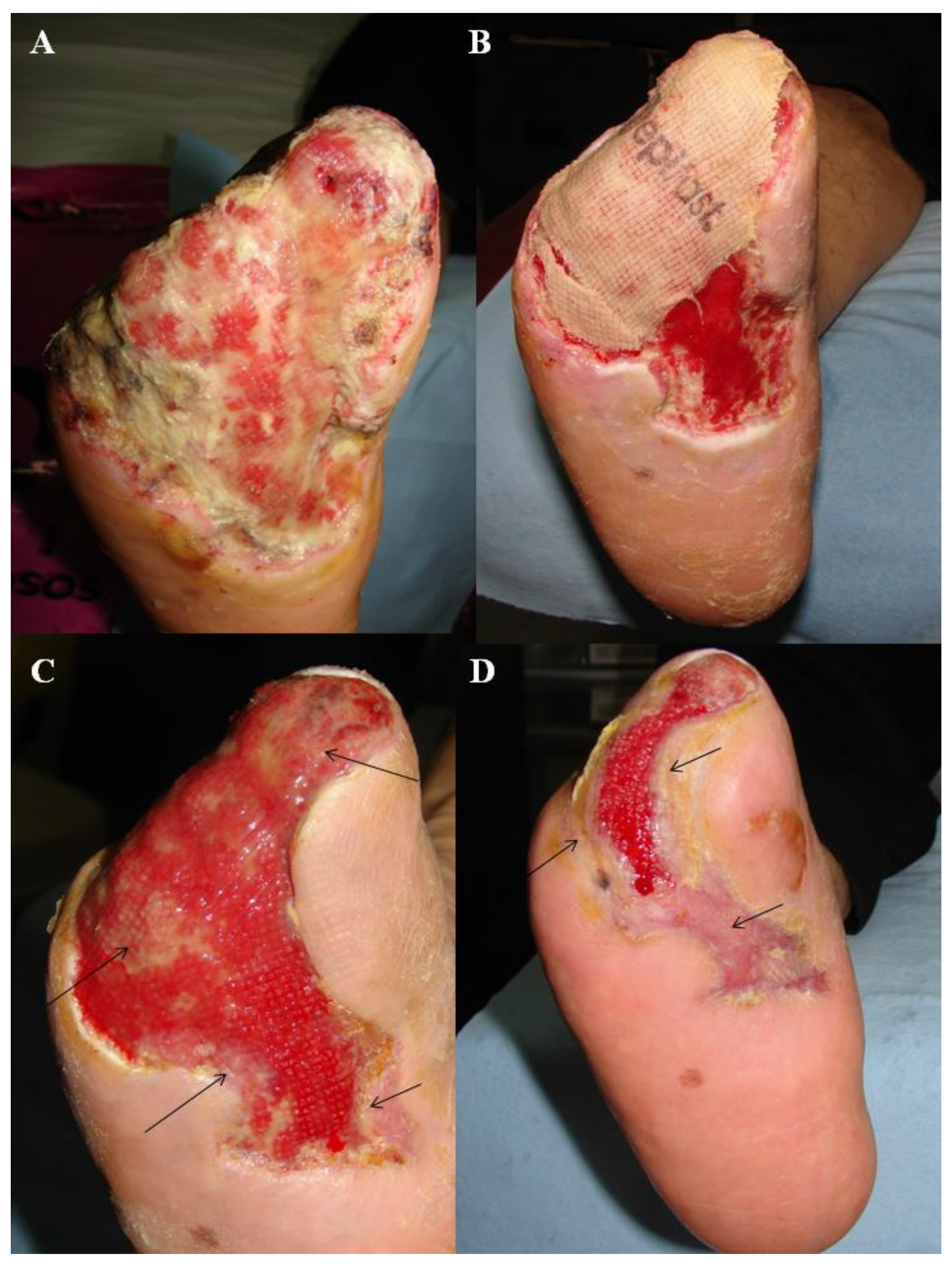 Jcm 11 07348 g003 Jcm 11 07348 g003