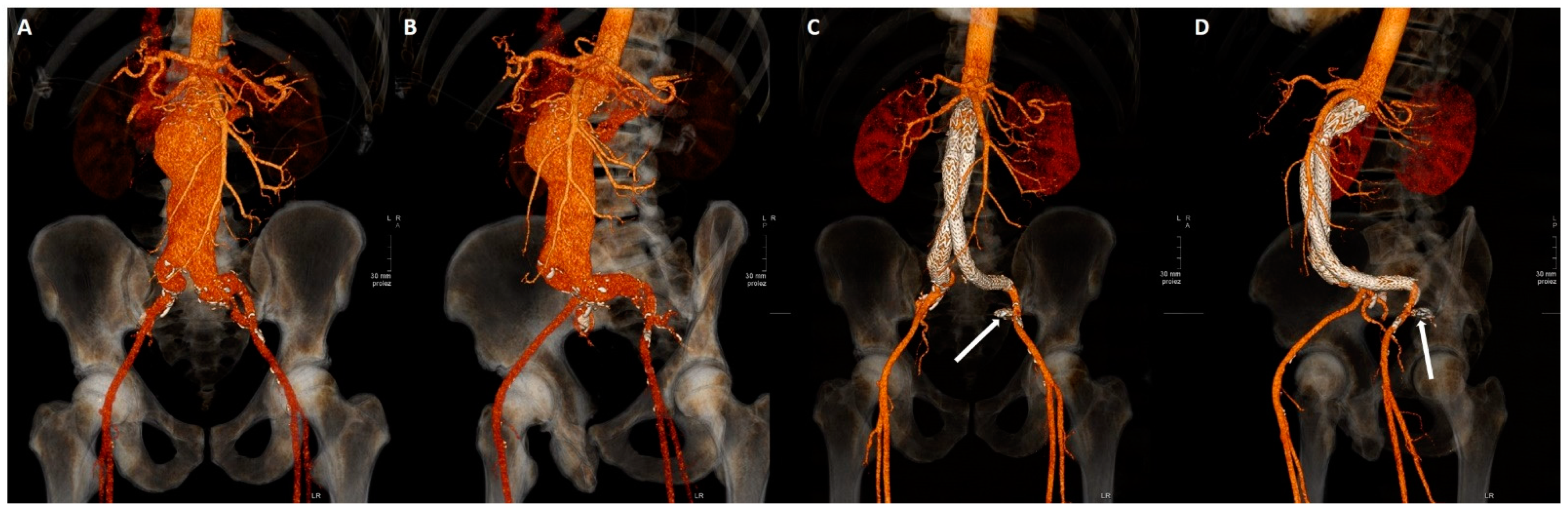Jcm 11 07399 g002 Jcm 11 07399 g002